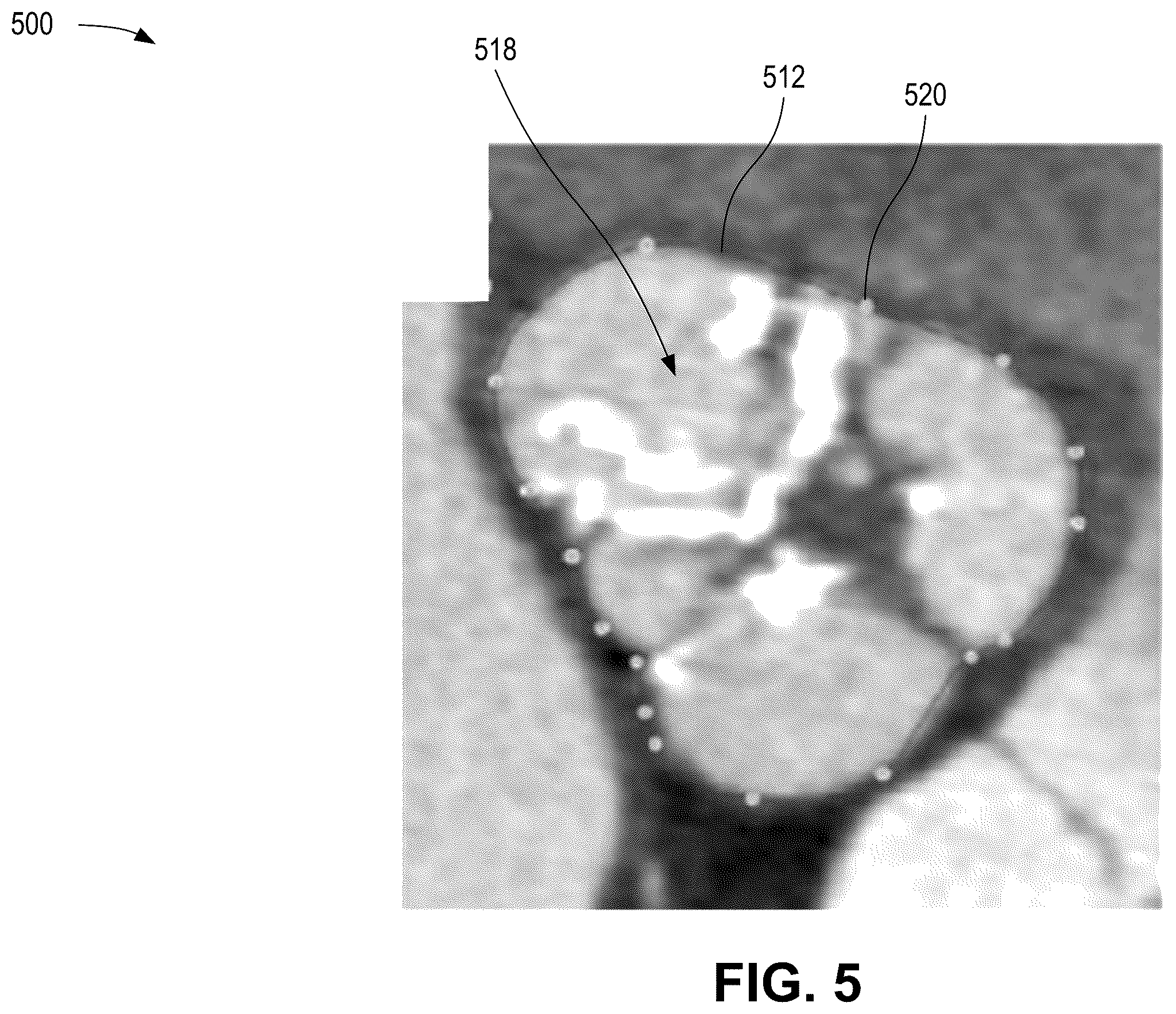 Patent US12376814 Figure 5 – Quantification of noncalcific and calcific valve tissue from coronary CT angiography
