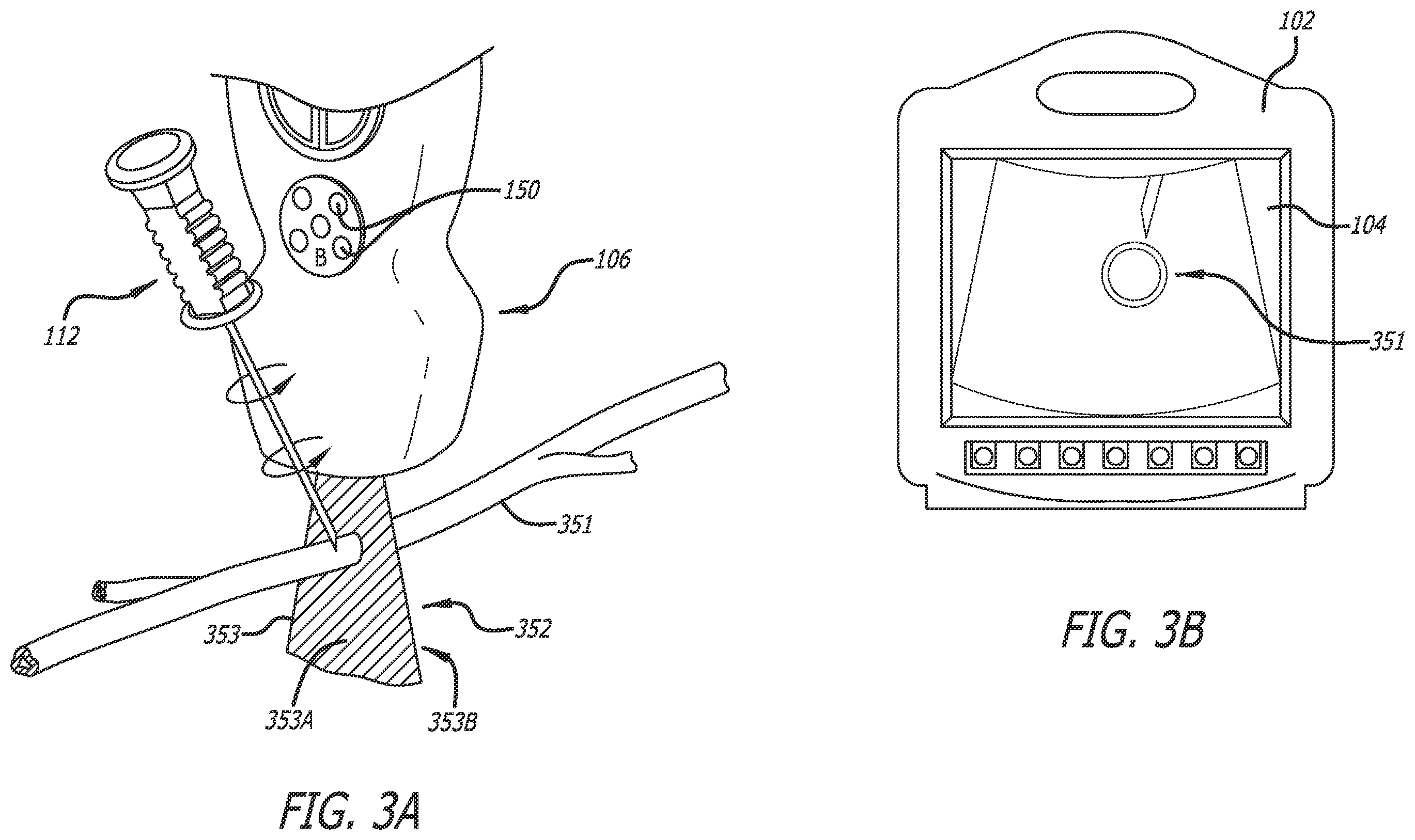 Patent US12376817 Figure 3 – Optimized functionality through interoperation of doppler and image based vessel differentiation