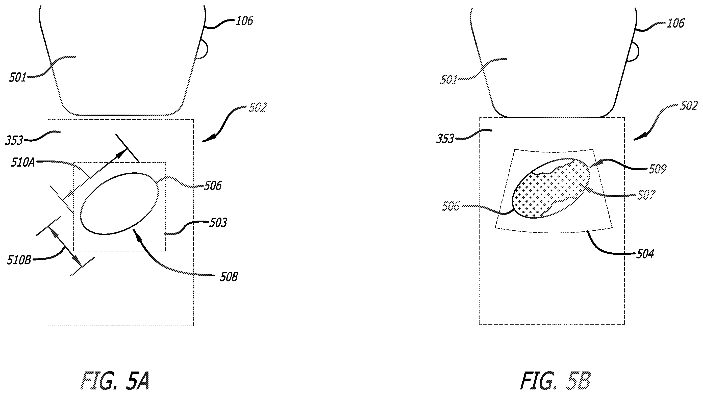 Patent US12376817 Figure 5 – Optimized functionality through interoperation of doppler and image based vessel differentiation