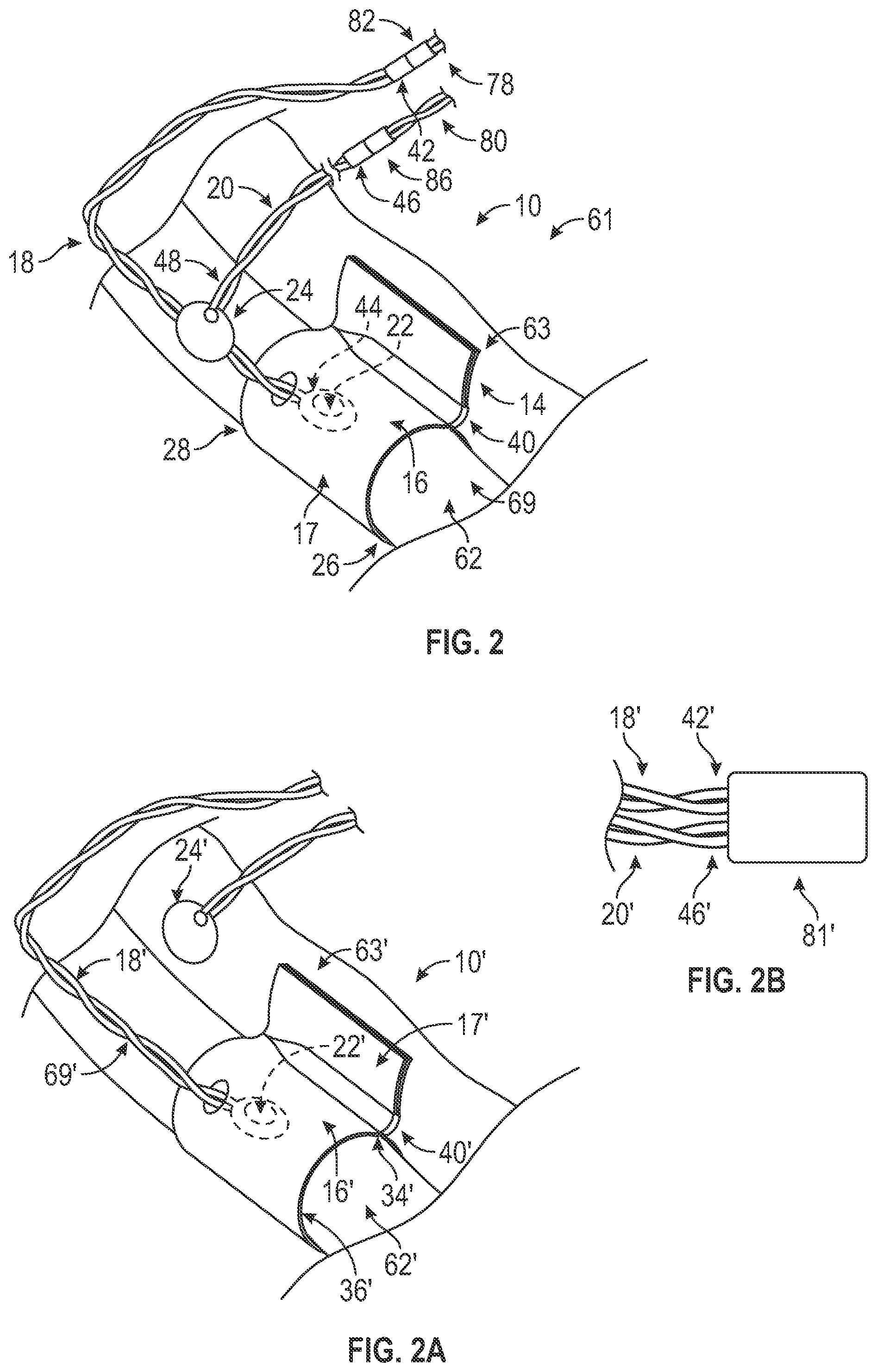 Patent US12376818 Figure 2 – Doppler probes, blood flow monitoring systems, and methods of monitoring blood flow