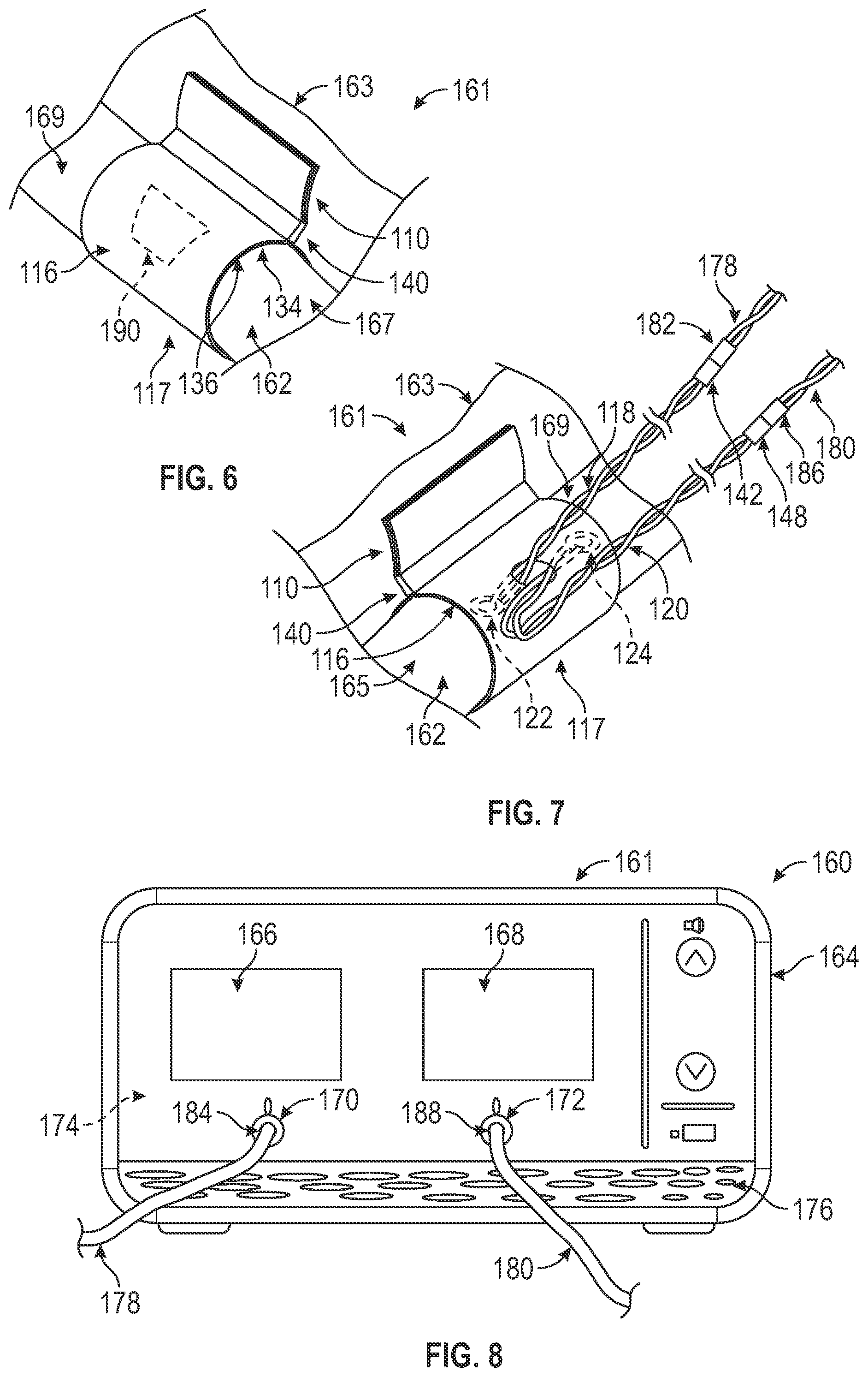 Patent US12376818 Figure 5 – Doppler probes, blood flow monitoring systems, and methods of monitoring blood flow