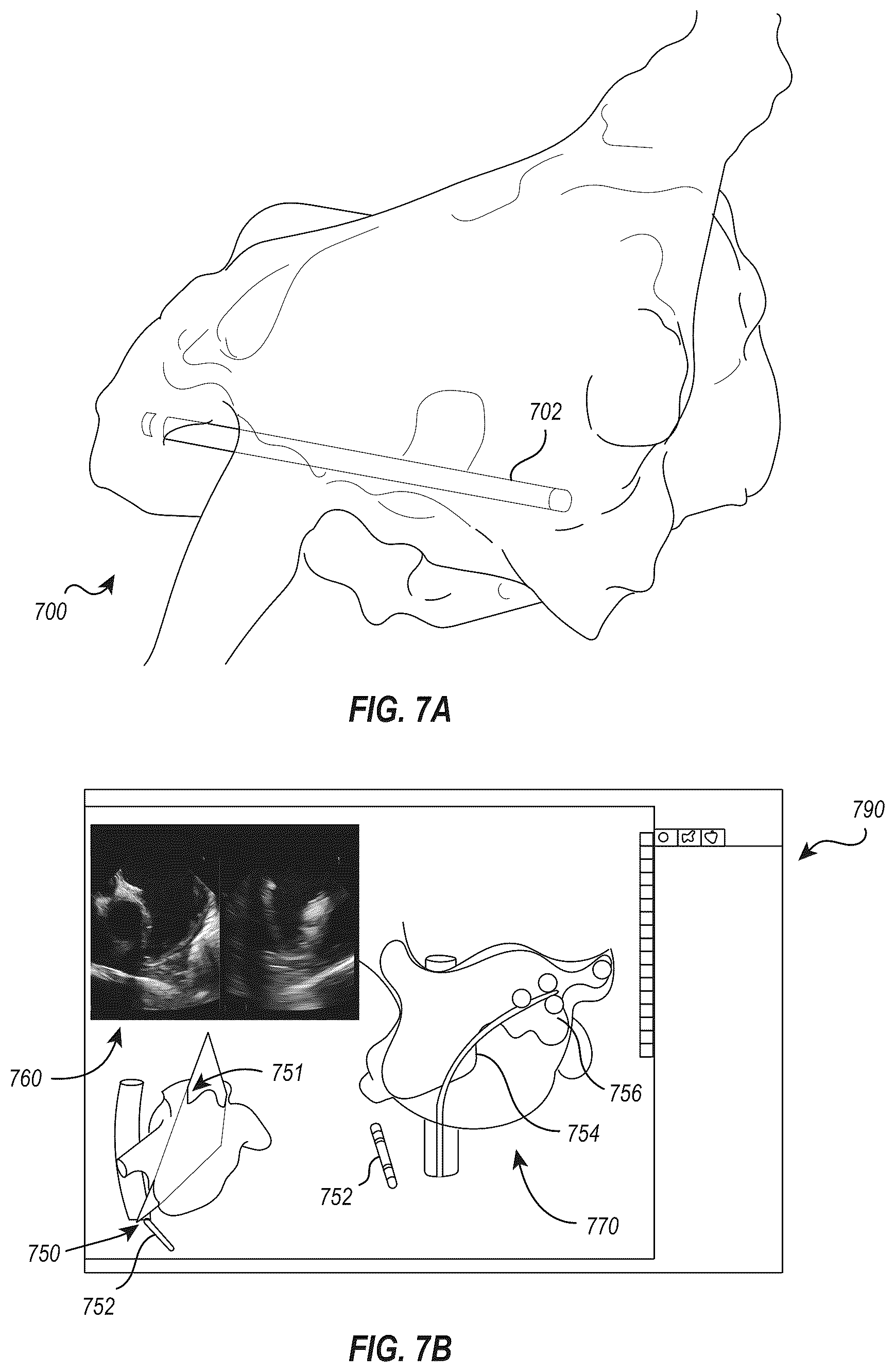 Patent US12376820 Figure 9 – Integrated imaging and device deployment platform