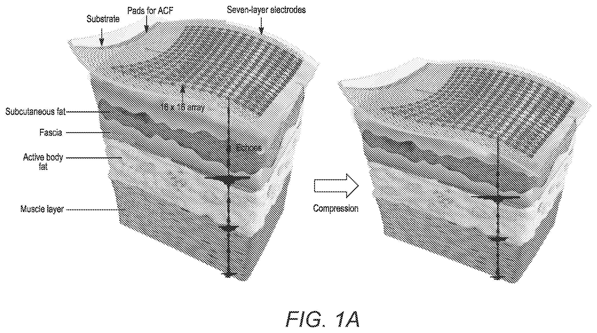 Patent US12376822 Figure 1 – Three-dimensional mapping of deep tissue modulus by stretchable ultrasonic arrays