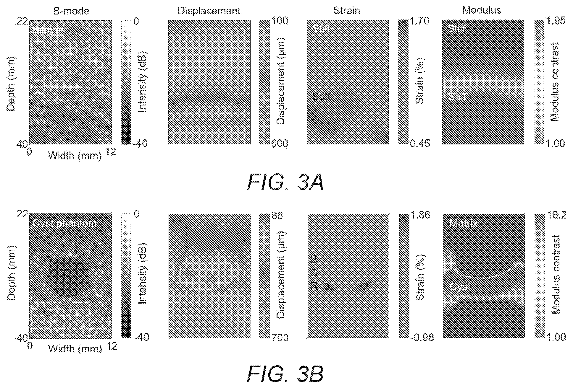 Patent US12376822 Figure 8 – Three-dimensional mapping of deep tissue modulus by stretchable ultrasonic arrays