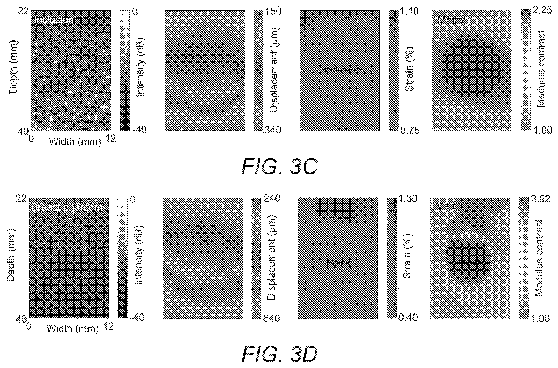 Patent US12376822 Figure 9 – Three-dimensional mapping of deep tissue modulus by stretchable ultrasonic arrays