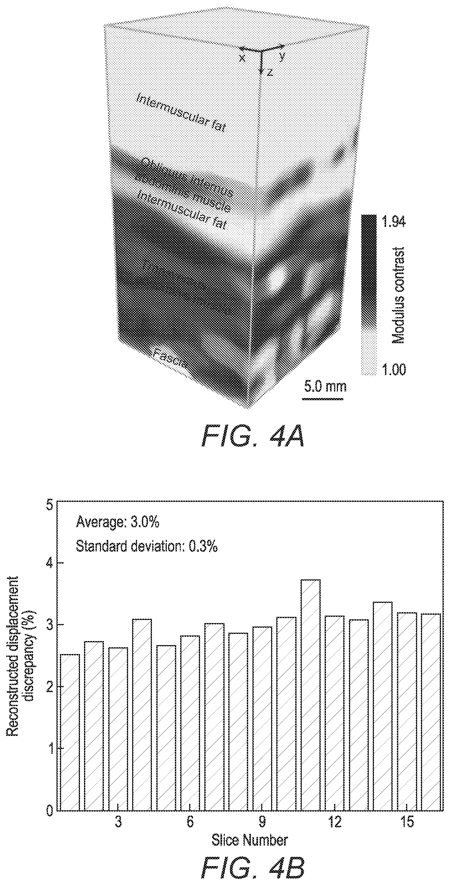 Patent US12376822 Figure 10 – Three-dimensional mapping of deep tissue modulus by stretchable ultrasonic arrays