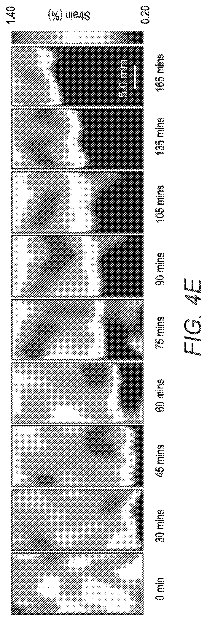 Patent US12376822 Figure 12 – Three-dimensional mapping of deep tissue modulus by stretchable ultrasonic arrays
