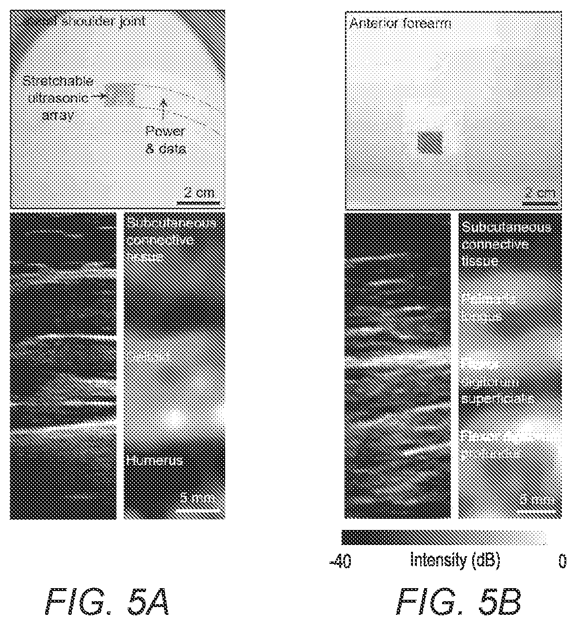 Patent US12376822 Figure 13 – Three-dimensional mapping of deep tissue modulus by stretchable ultrasonic arrays