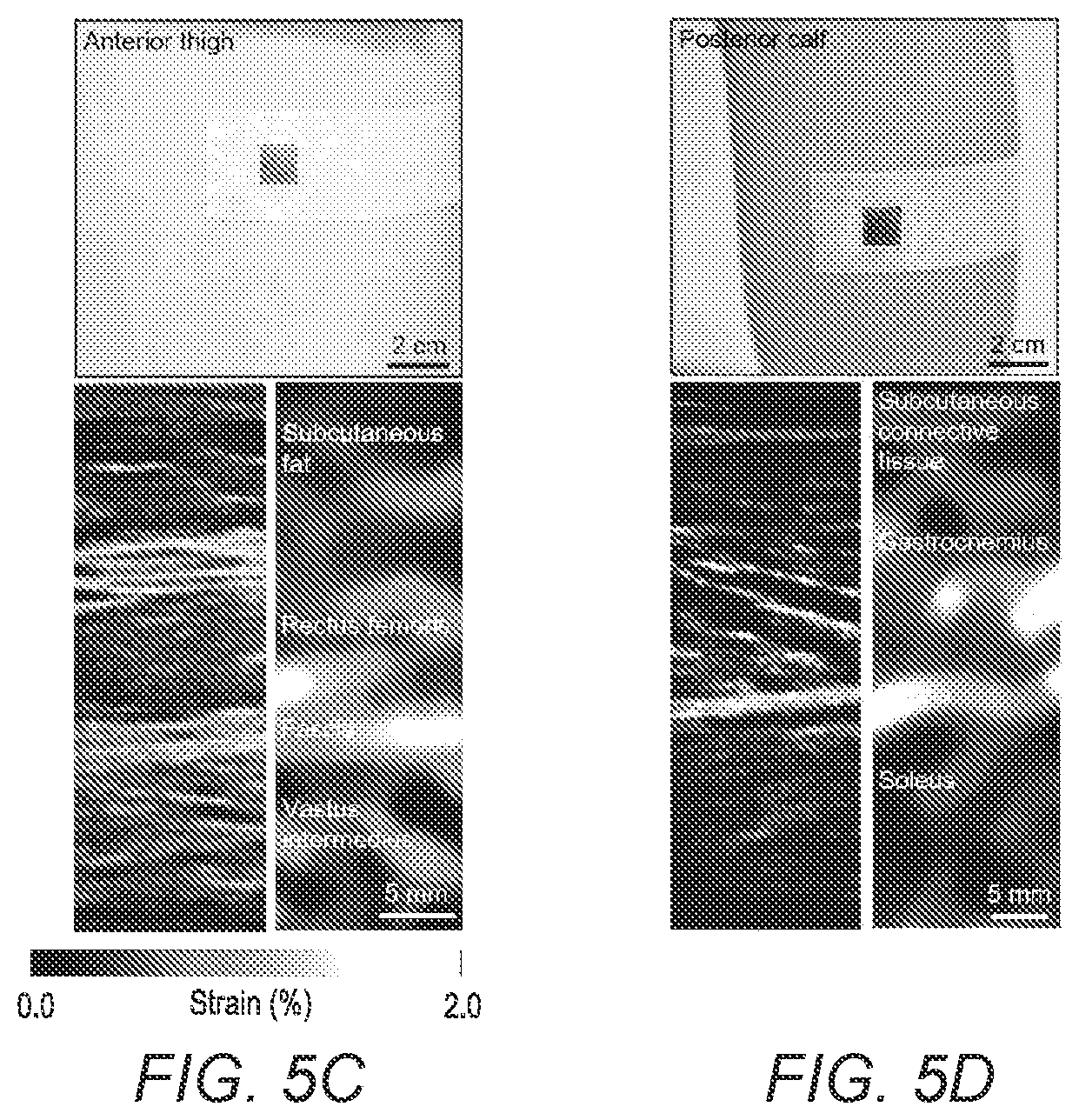 Patent US12376822 Figure 14 – Three-dimensional mapping of deep tissue modulus by stretchable ultrasonic arrays