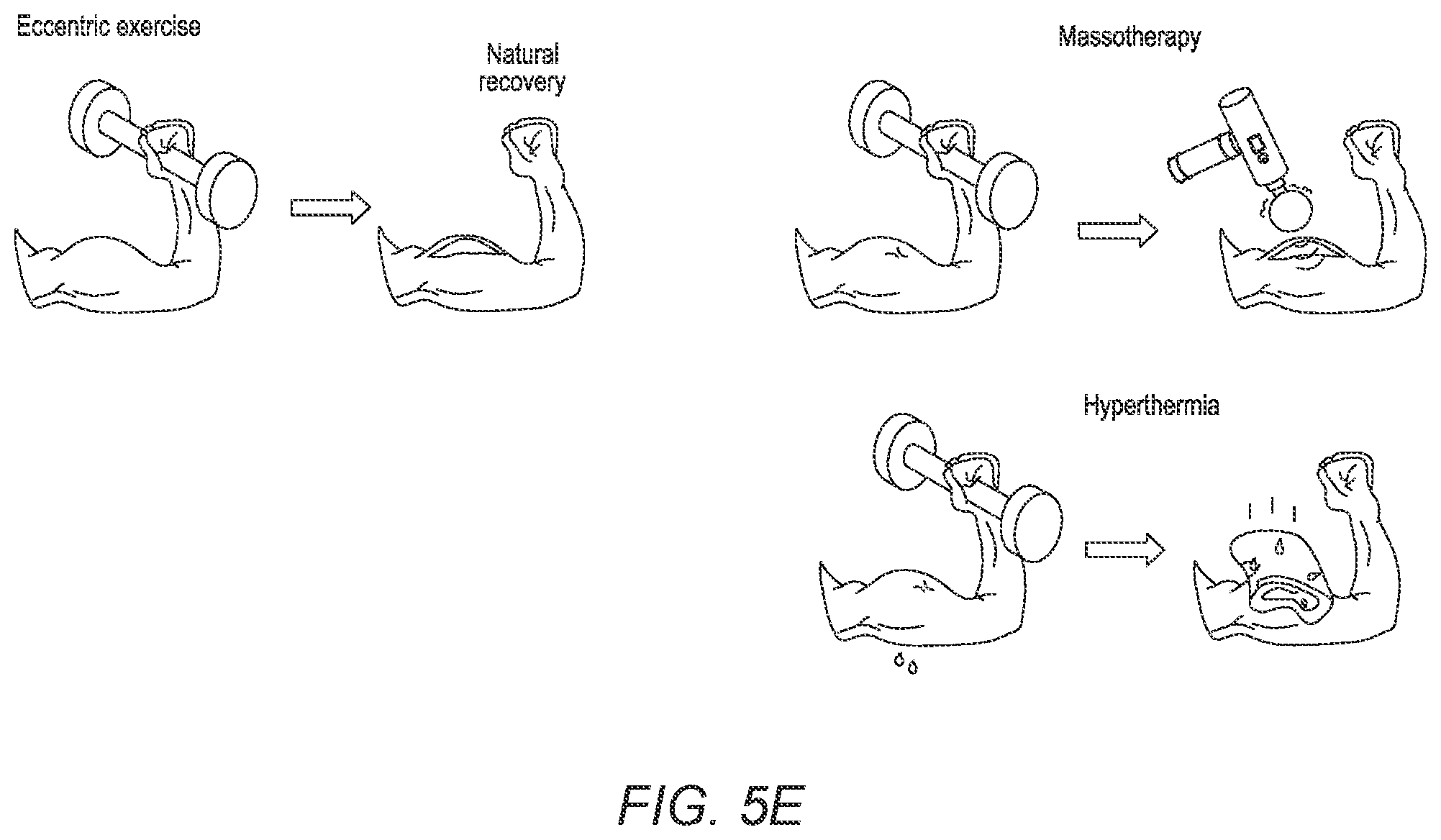 Patent US12376822 Figure 15 – Three-dimensional mapping of deep tissue modulus by stretchable ultrasonic arrays