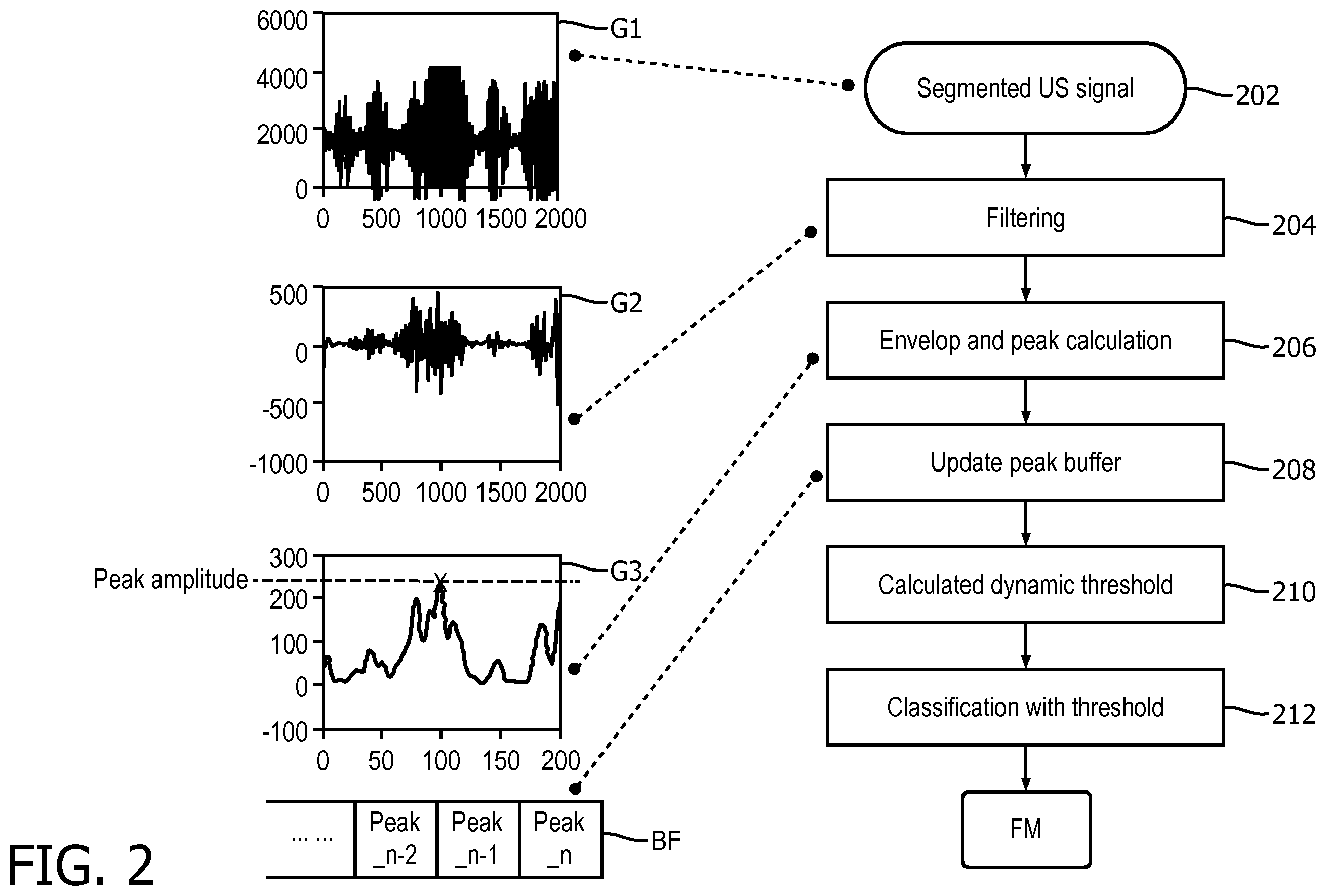 Patent US12376823 Figure 2 – Fetal movement detection method from doppler ultrasound signal
