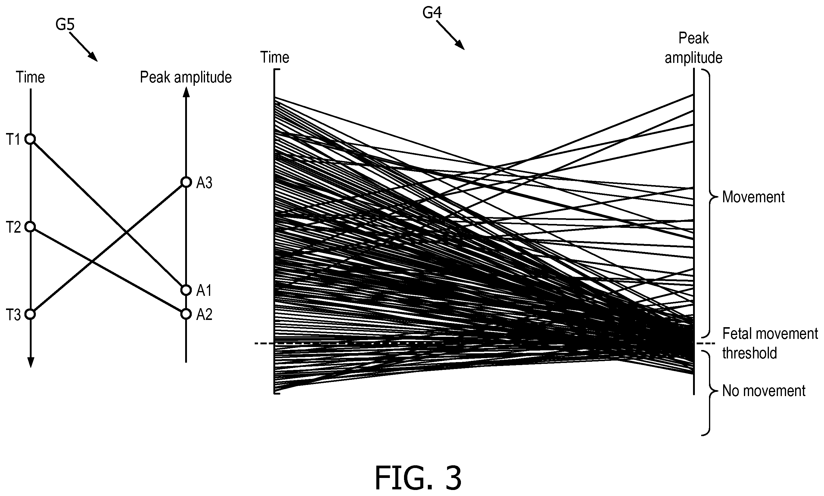 Patent US12376823 Figure 3 – Fetal movement detection method from doppler ultrasound signal