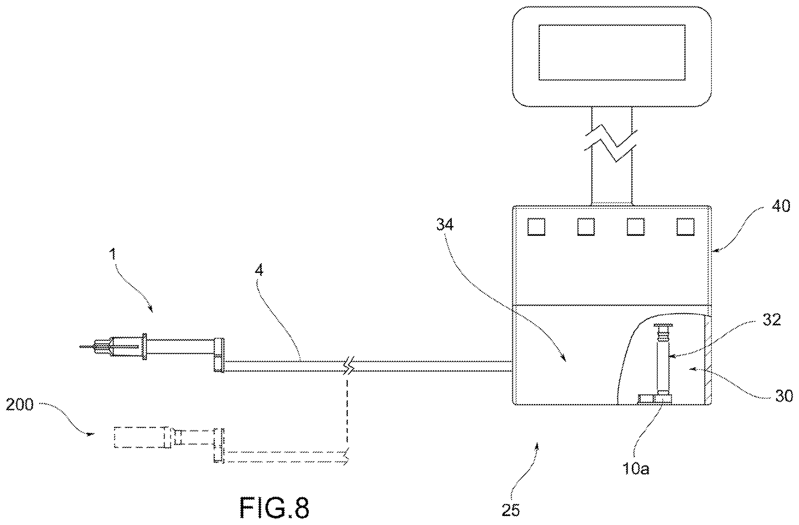 Patent US12376825 Figure 6 – Device for the direct detection of pressure variations of a fluid in a body cavity