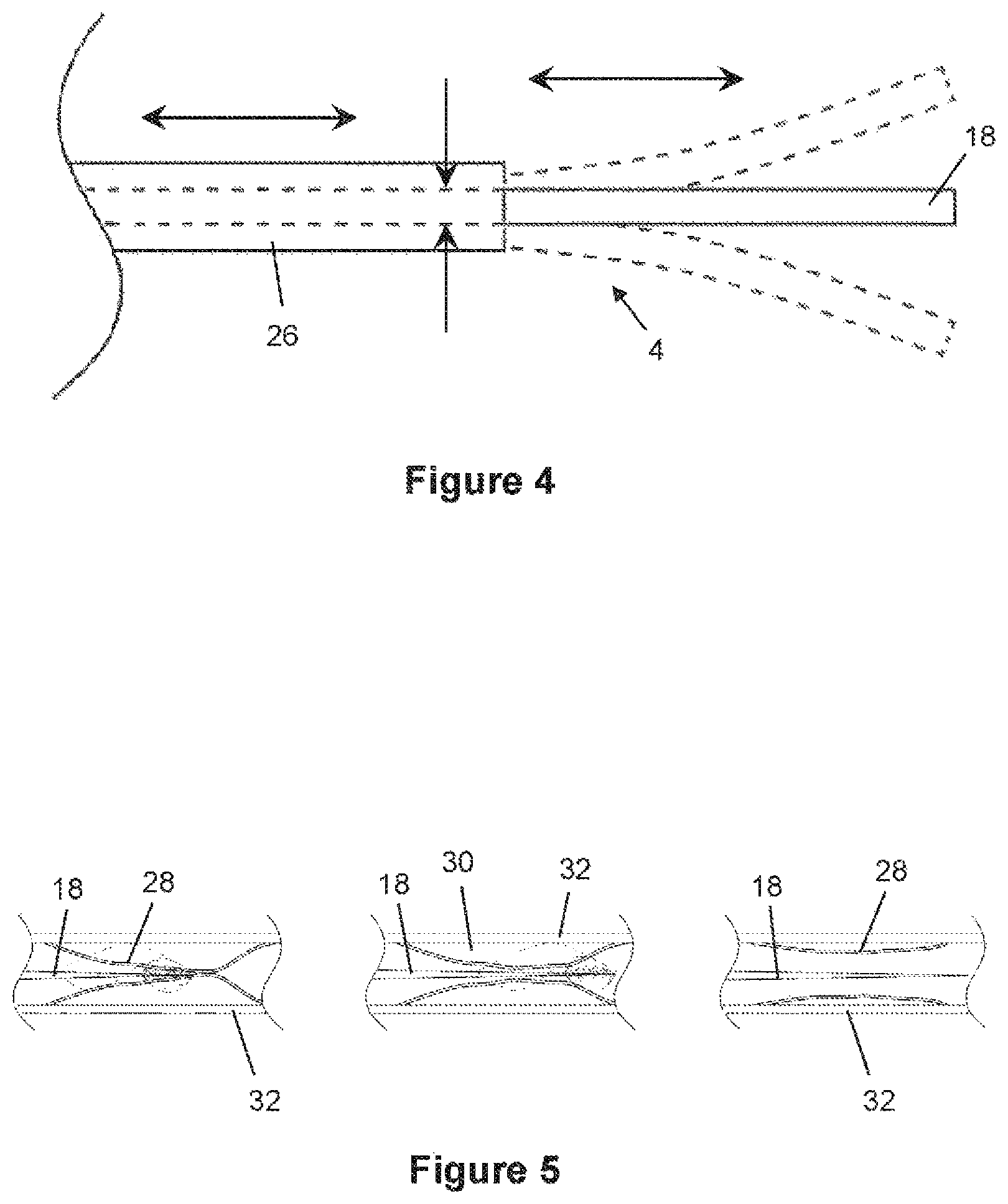Patent US12376826 Figure 3 – Determining the condition of vessels in the body