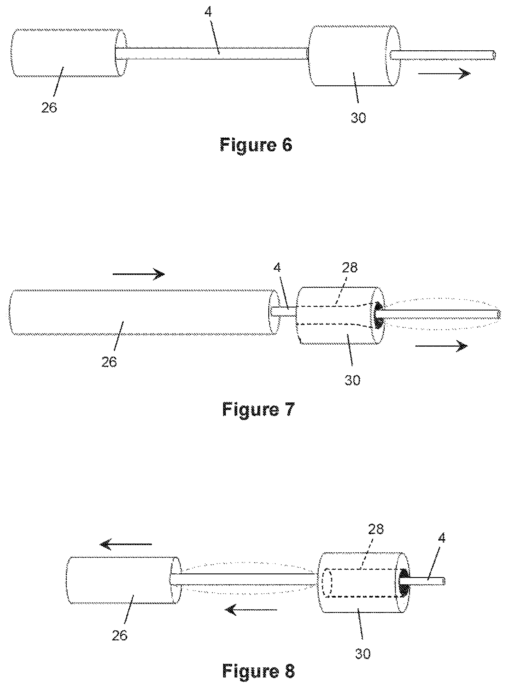 Patent US12376826 Figure 4 – Determining the condition of vessels in the body