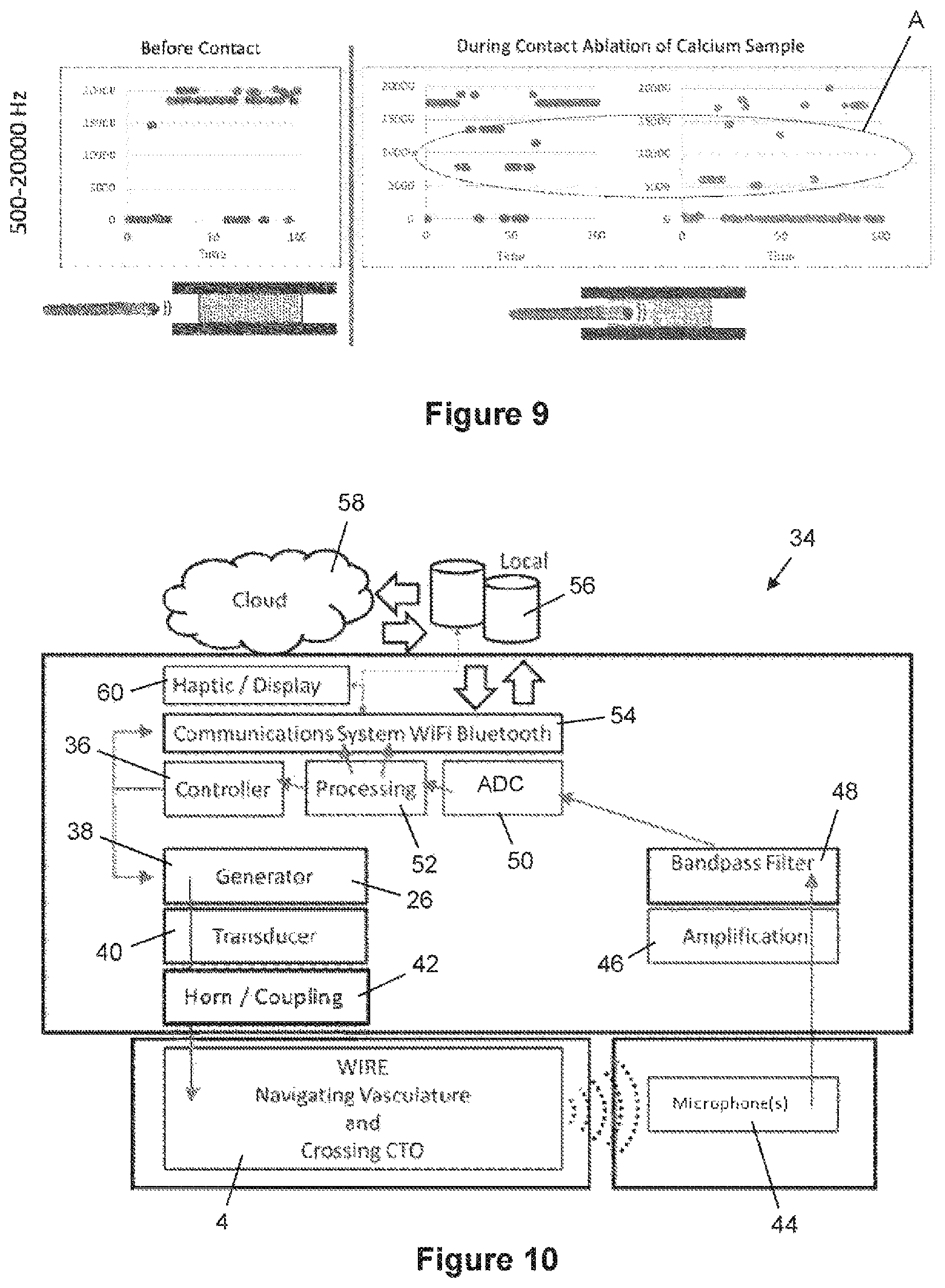 Patent US12376826 Figure 5 – Determining the condition of vessels in the body