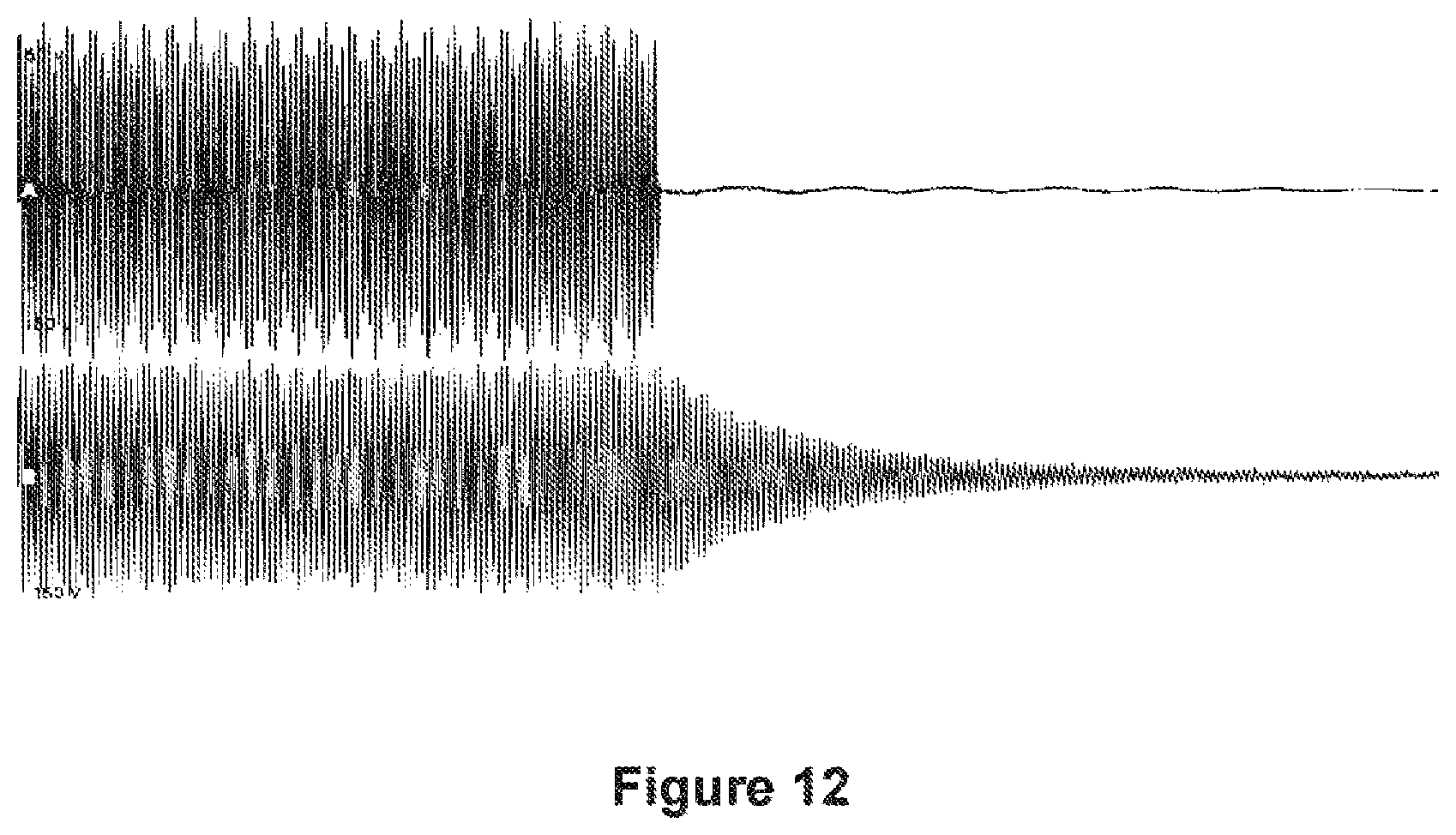 Patent US12376826 Figure 7 – Determining the condition of vessels in the body