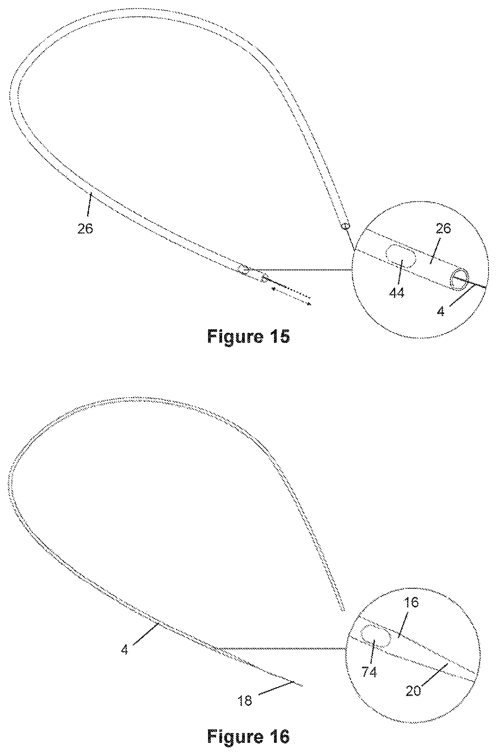 Patent US12376826 Figure 9 – Determining the condition of vessels in the body
