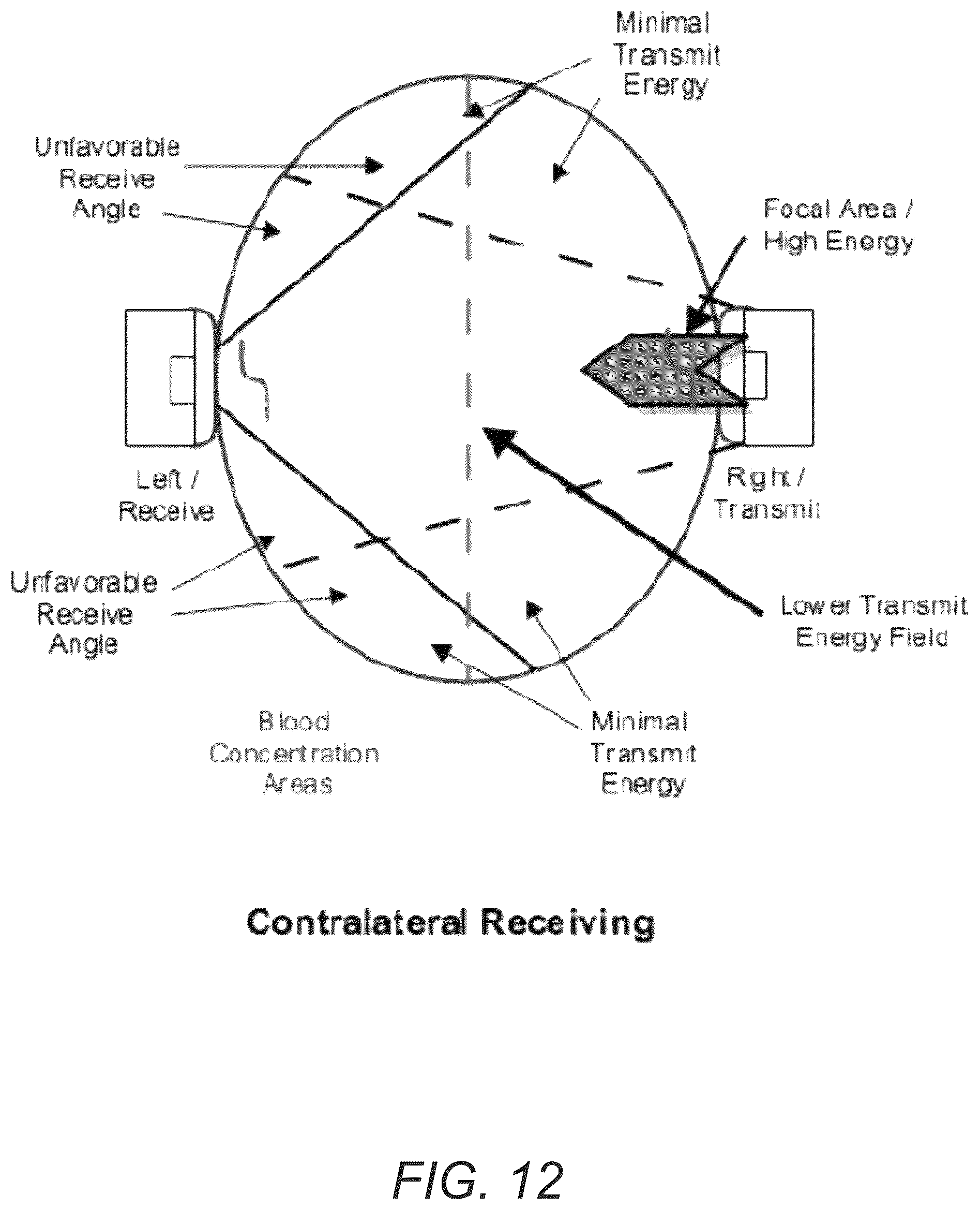 Patent US12376827 Figure 14 – Portable ultrasound device