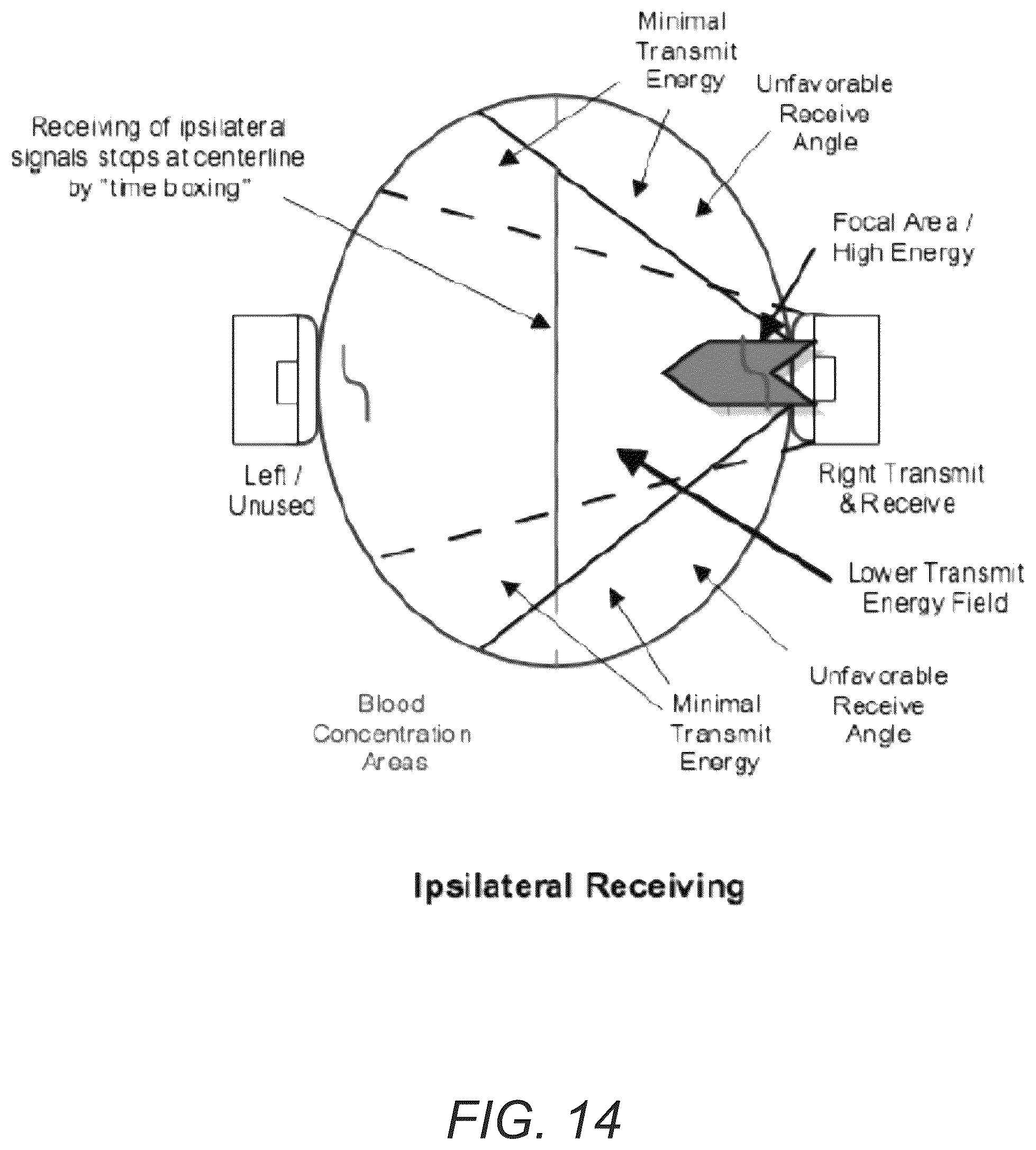 Patent US12376827 Figure 16 – Portable ultrasound device