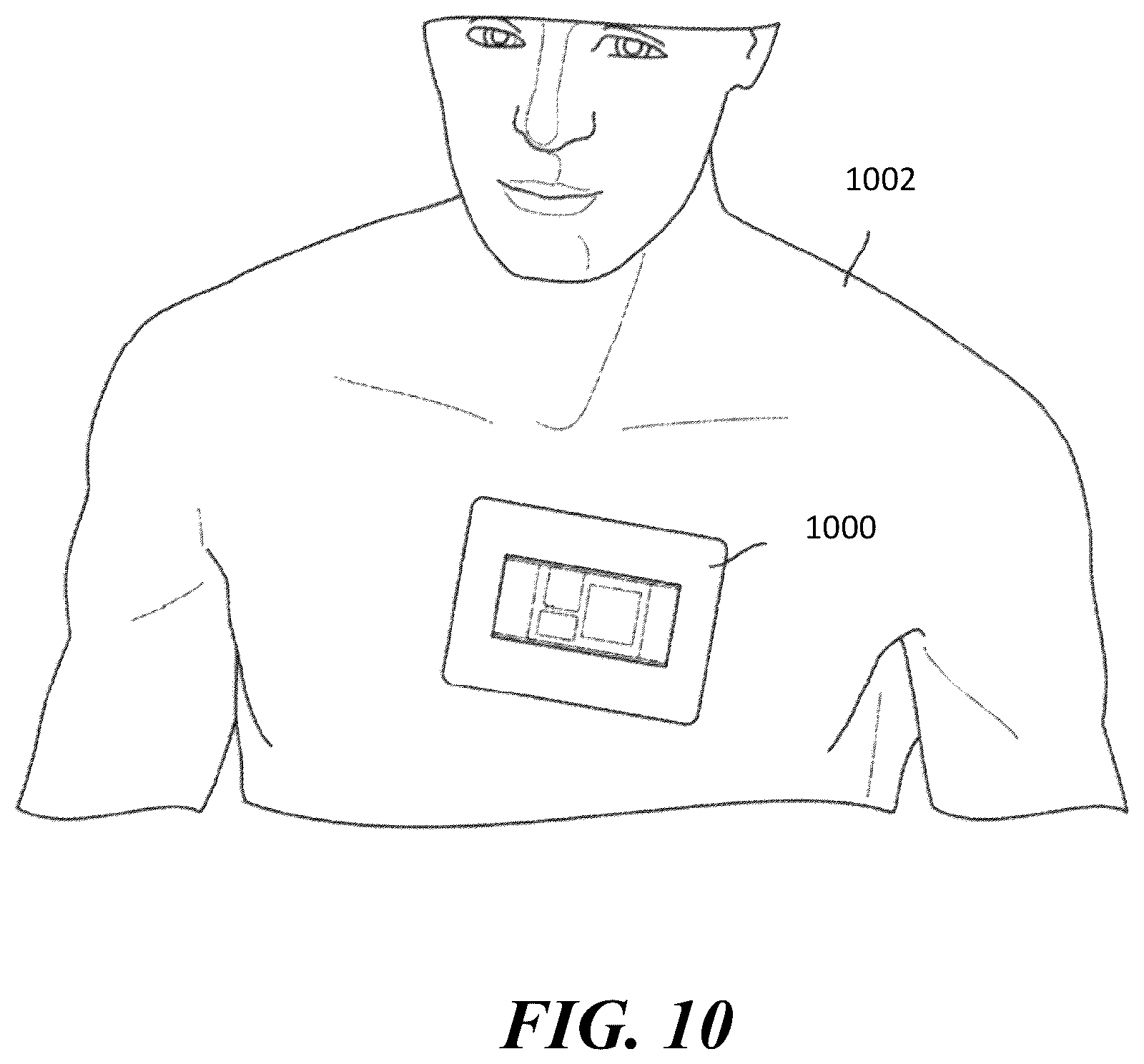 Patent US12376828 Figure 13 – Methods and systems for coherence imaging in obtaining ultrasound images