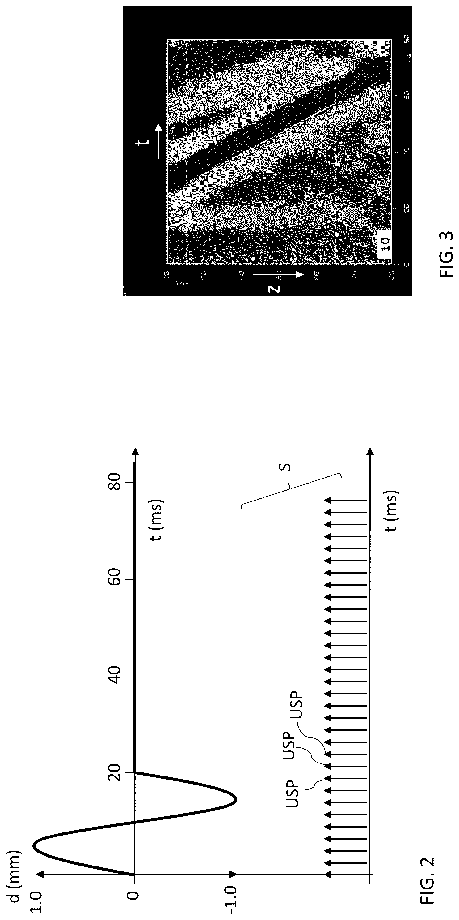 Patent US12376829 Figure 2 – Elastography device and method