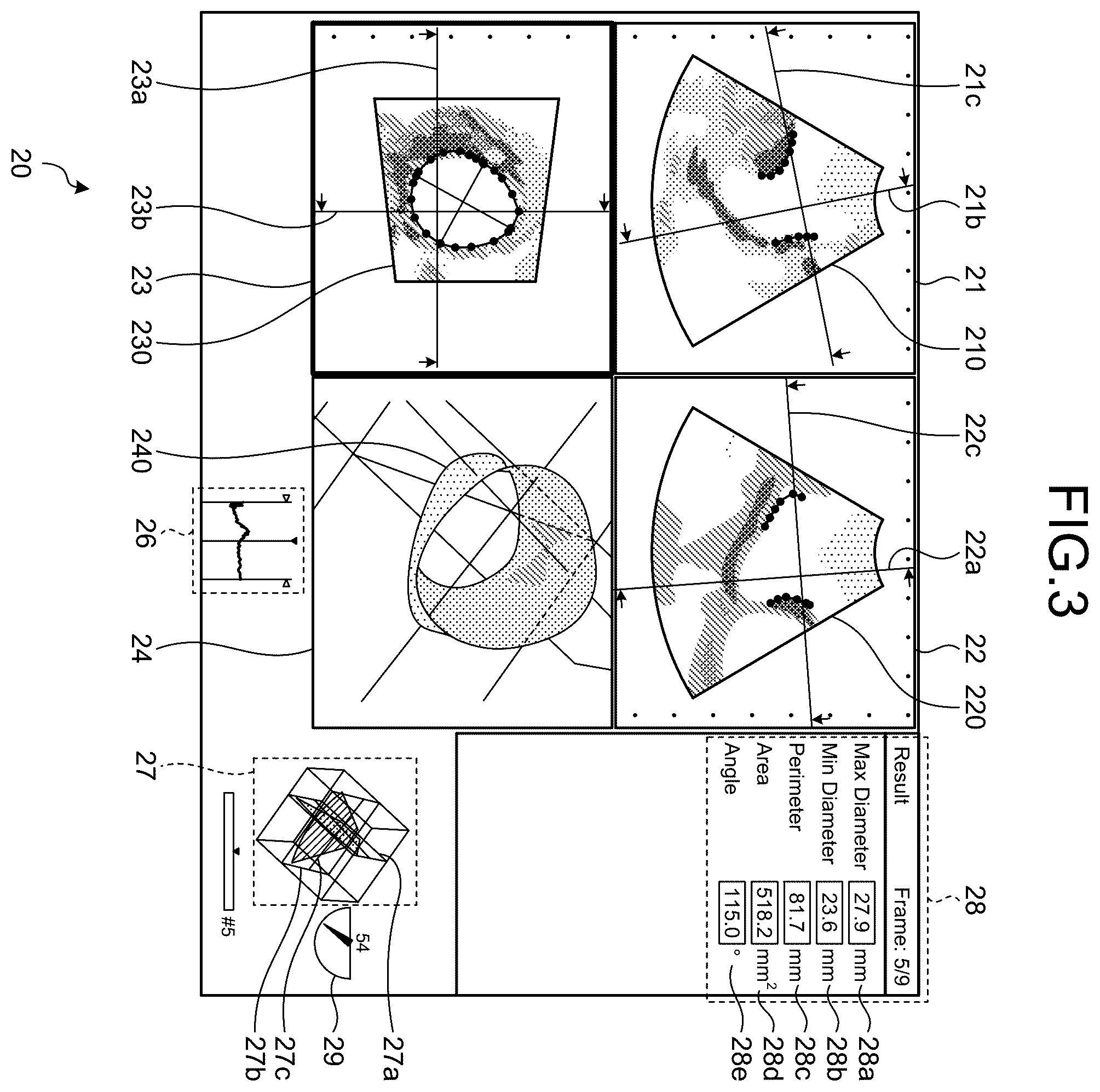 Patent US12376830 Figure 3 – Medical image diagnosis apparatus, medical information processing apparatus, and medical image processing method
