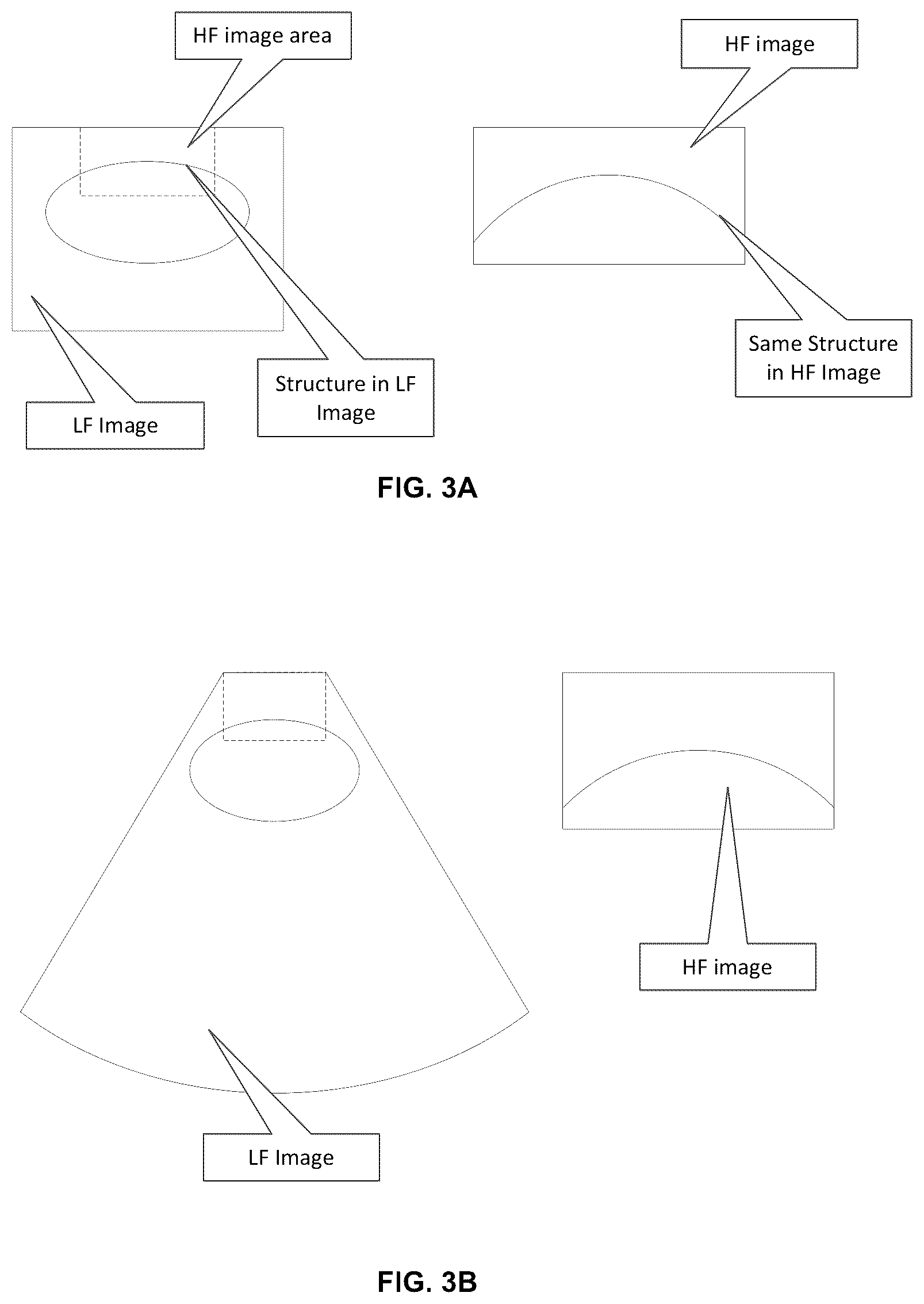 Patent US12376831 Figure 3 – Ultrasound system with high frequency detail