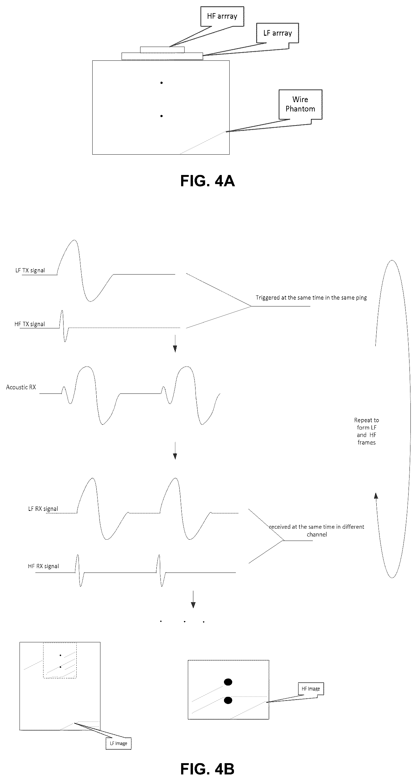 Patent US12376831 Figure 4 – Ultrasound system with high frequency detail