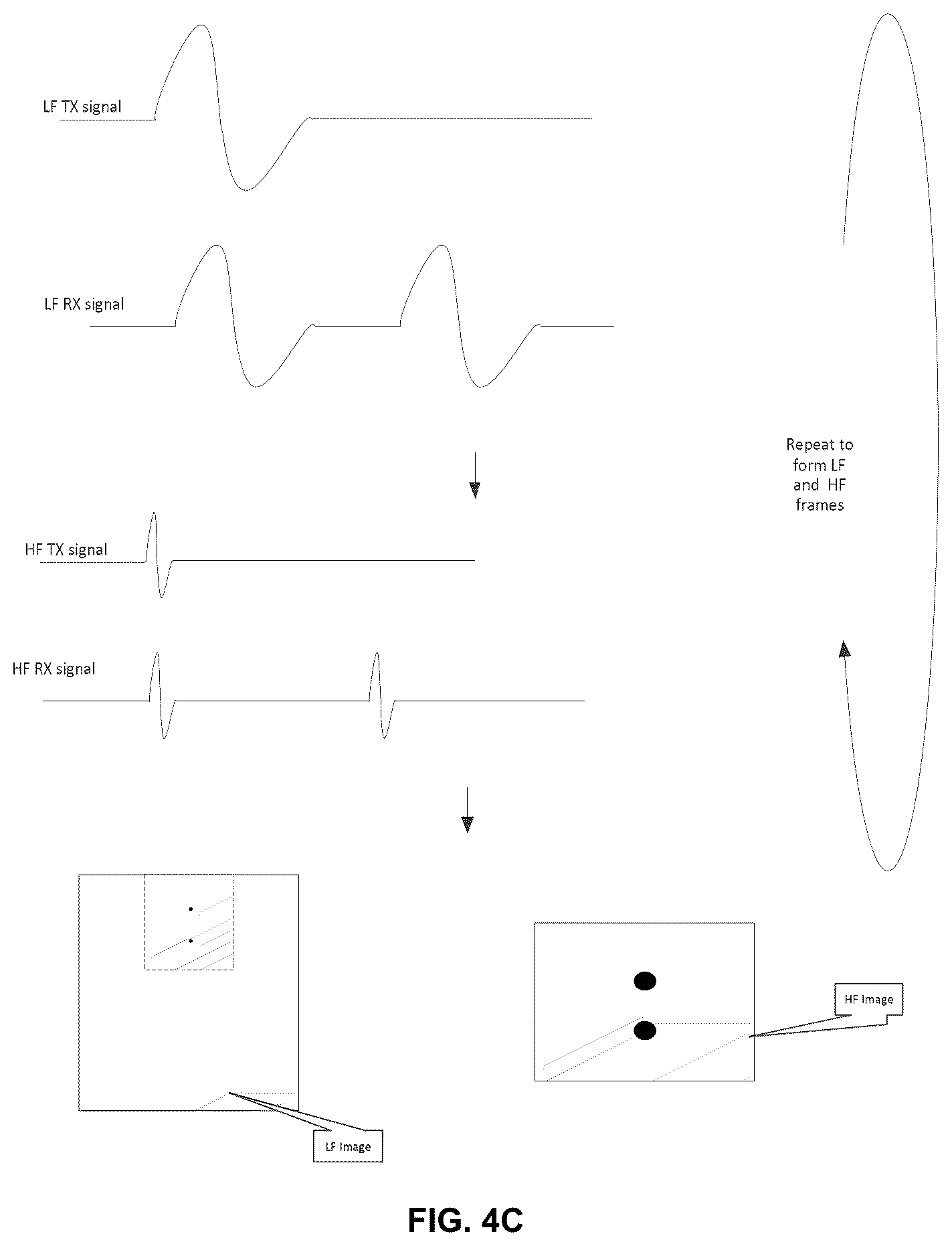 Patent US12376831 Figure 5 – Ultrasound system with high frequency detail