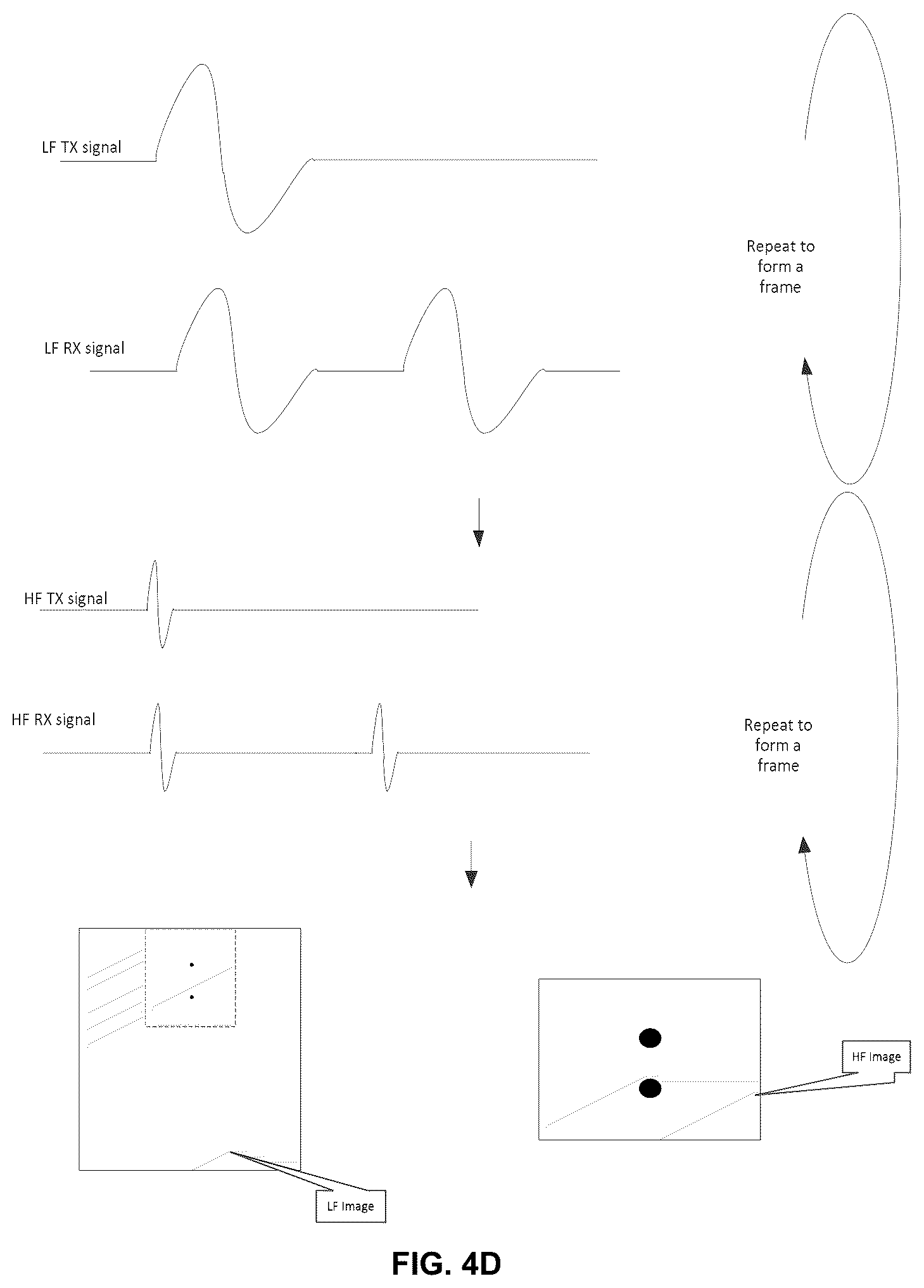 Patent US12376831 Figure 6 – Ultrasound system with high frequency detail