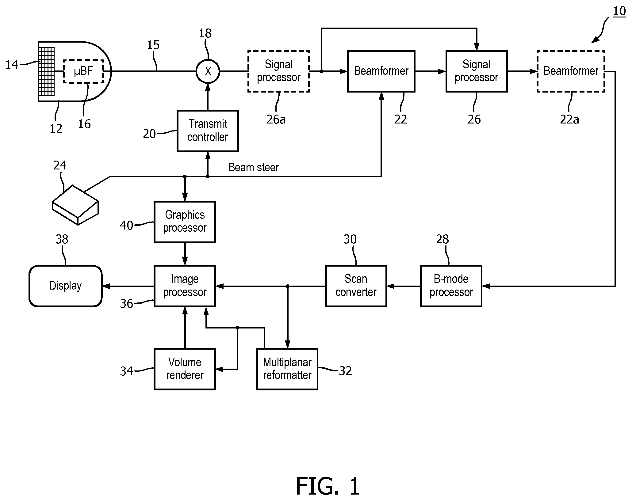 Patent US12376833 Figure 1 – Methods and systems for random noise supression and filtering of acoustic clutter via autoregressive moving average filter