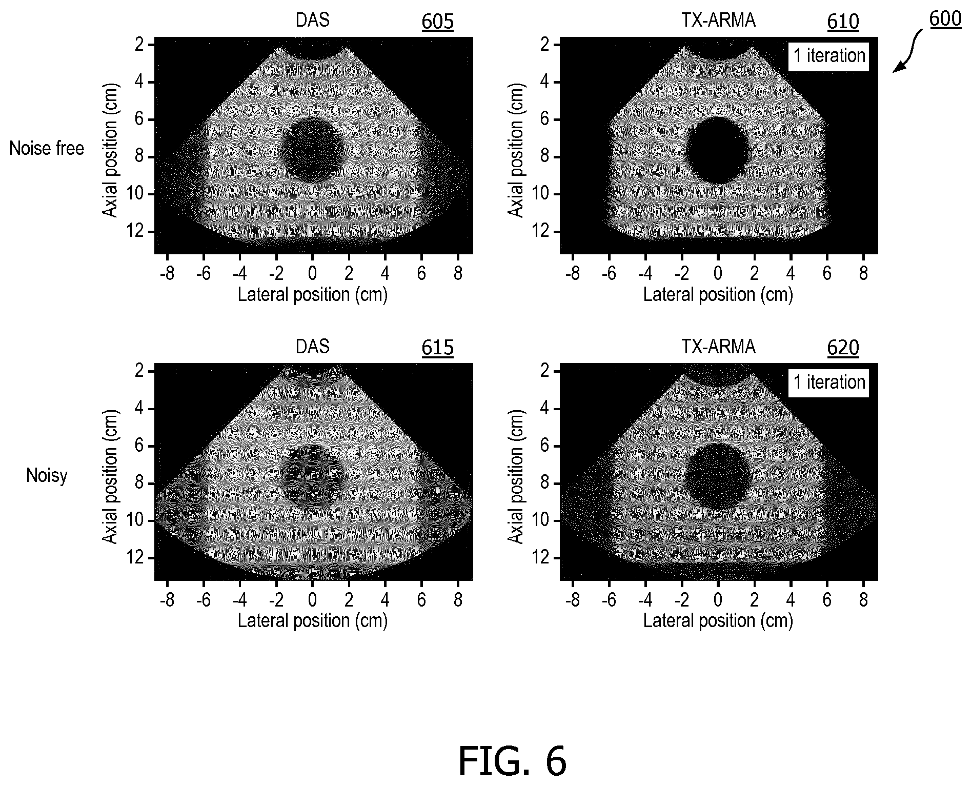 Patent US12376833 Figure 6 – Methods and systems for random noise supression and filtering of acoustic clutter via autoregressive moving average filter