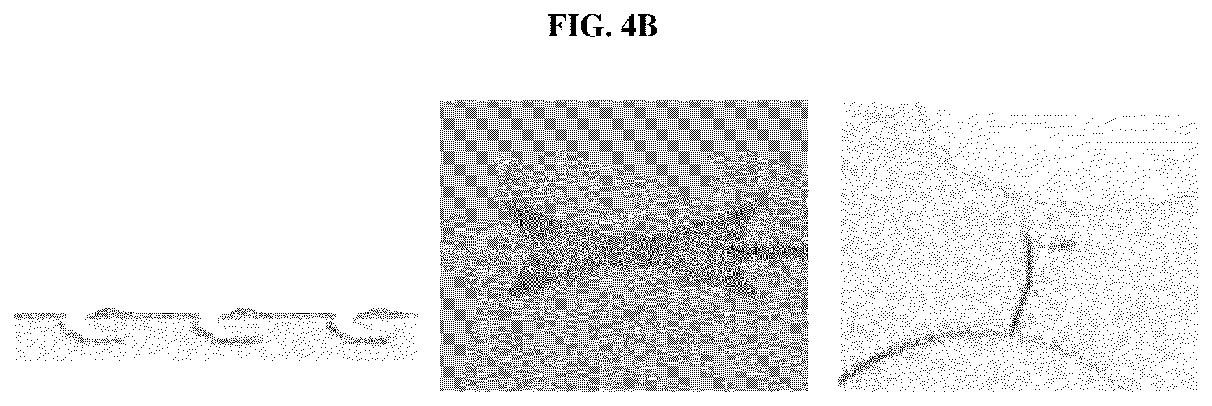 Patent US12376836 Figure 5 – Microfluidic device for detecting biomolecules in sweat and wearable biosensor patch using the same