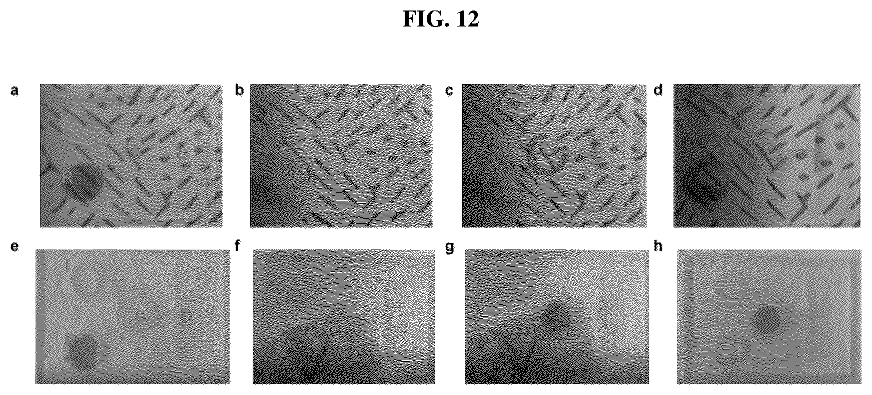Patent US12376836 Figure 13 – Microfluidic device for detecting biomolecules in sweat and wearable biosensor patch using the same