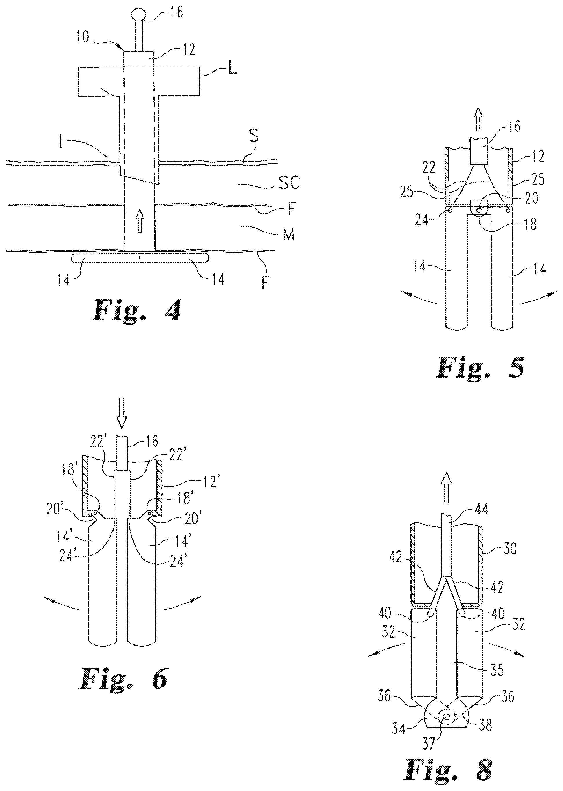 Patent US12376839 Figure 2 – Laparoscopic port site closure tool