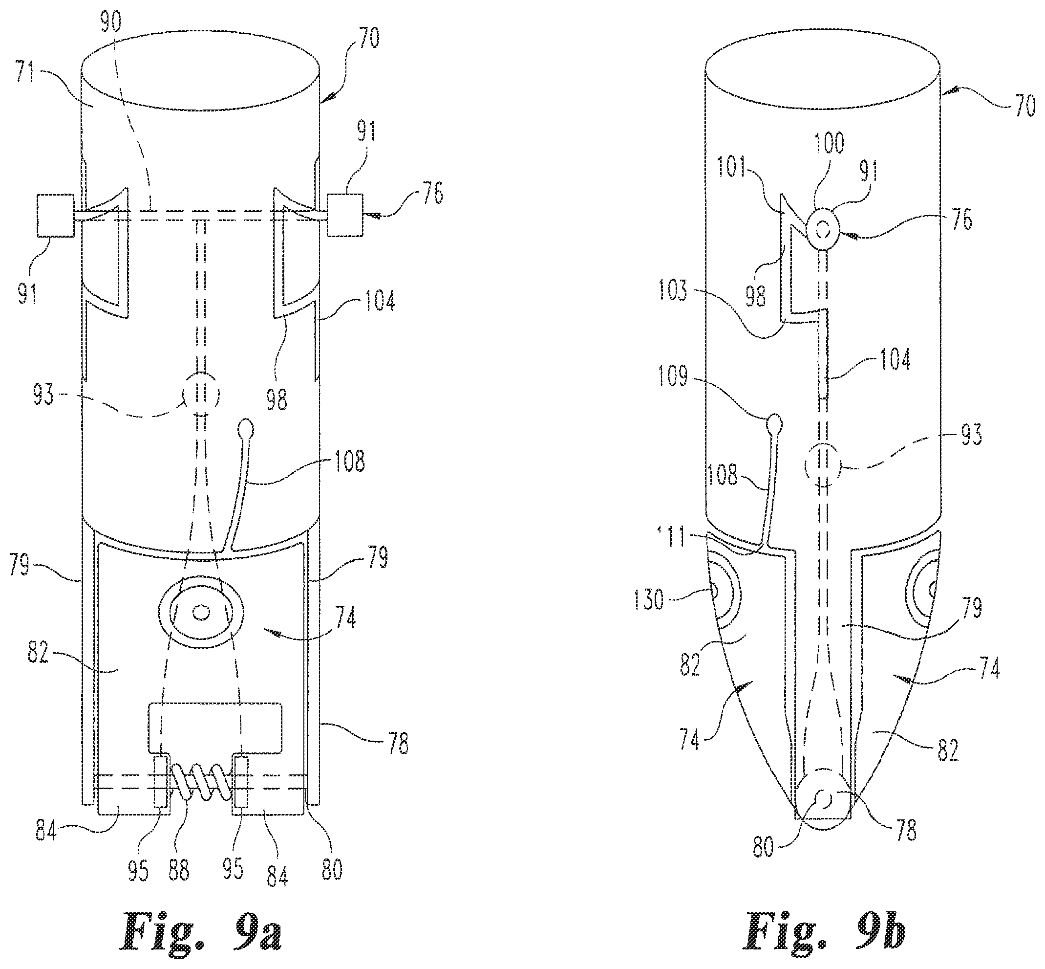 Patent US12376839 Figure 4 – Laparoscopic port site closure tool
