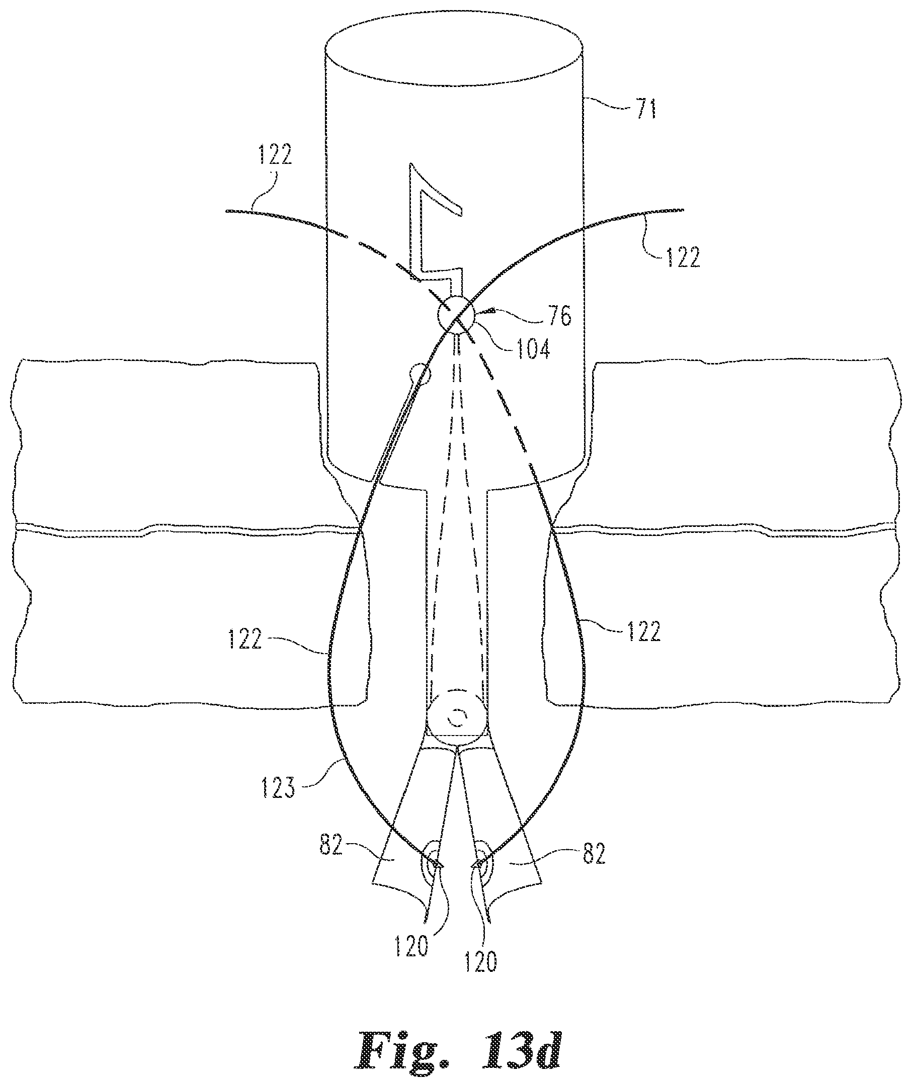 Patent US12376839 Figure 10 – Laparoscopic port site closure tool