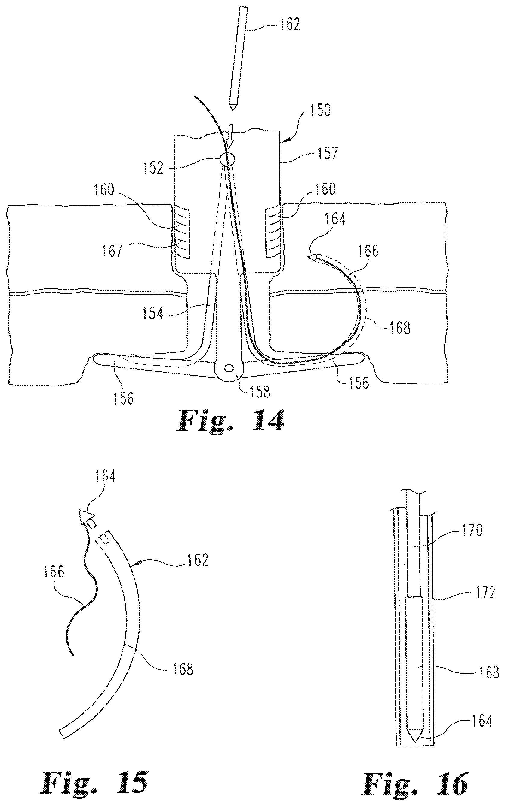 Patent US12376839 Figure 12 – Laparoscopic port site closure tool