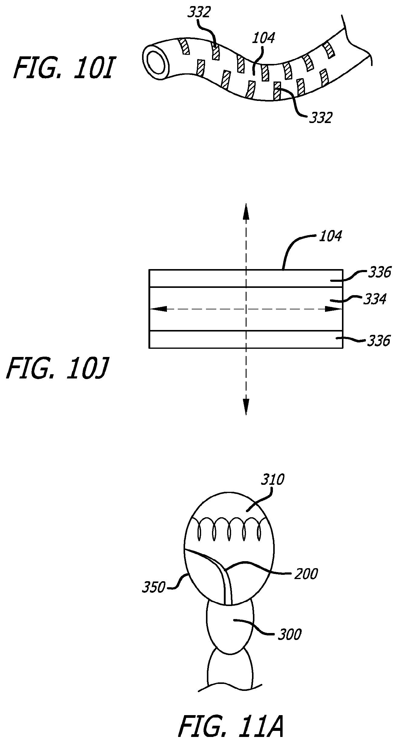 Patent US12376842 Figure 11 – Flexible system for delivering an anchor