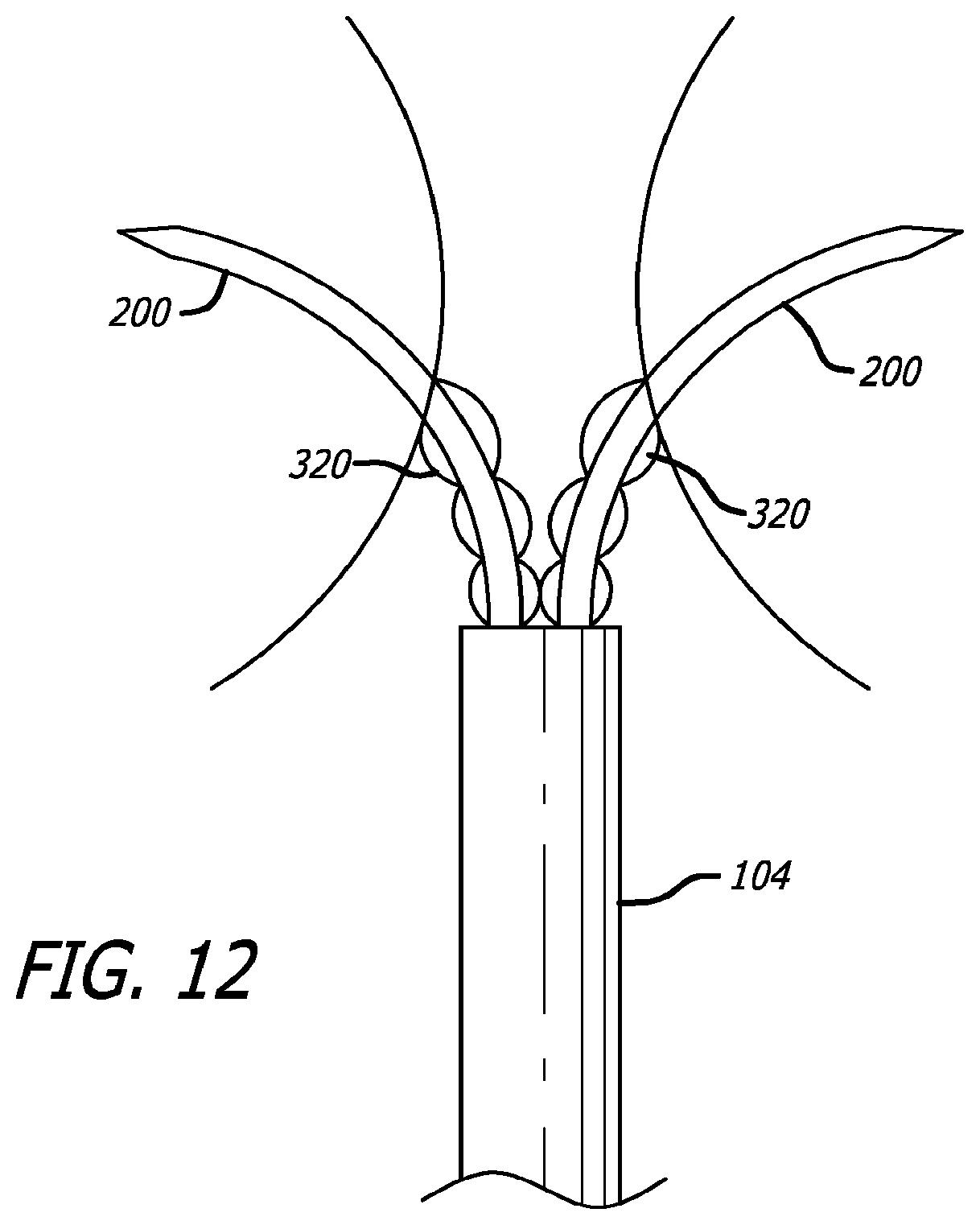 Patent US12376842 Figure 13 – Flexible system for delivering an anchor