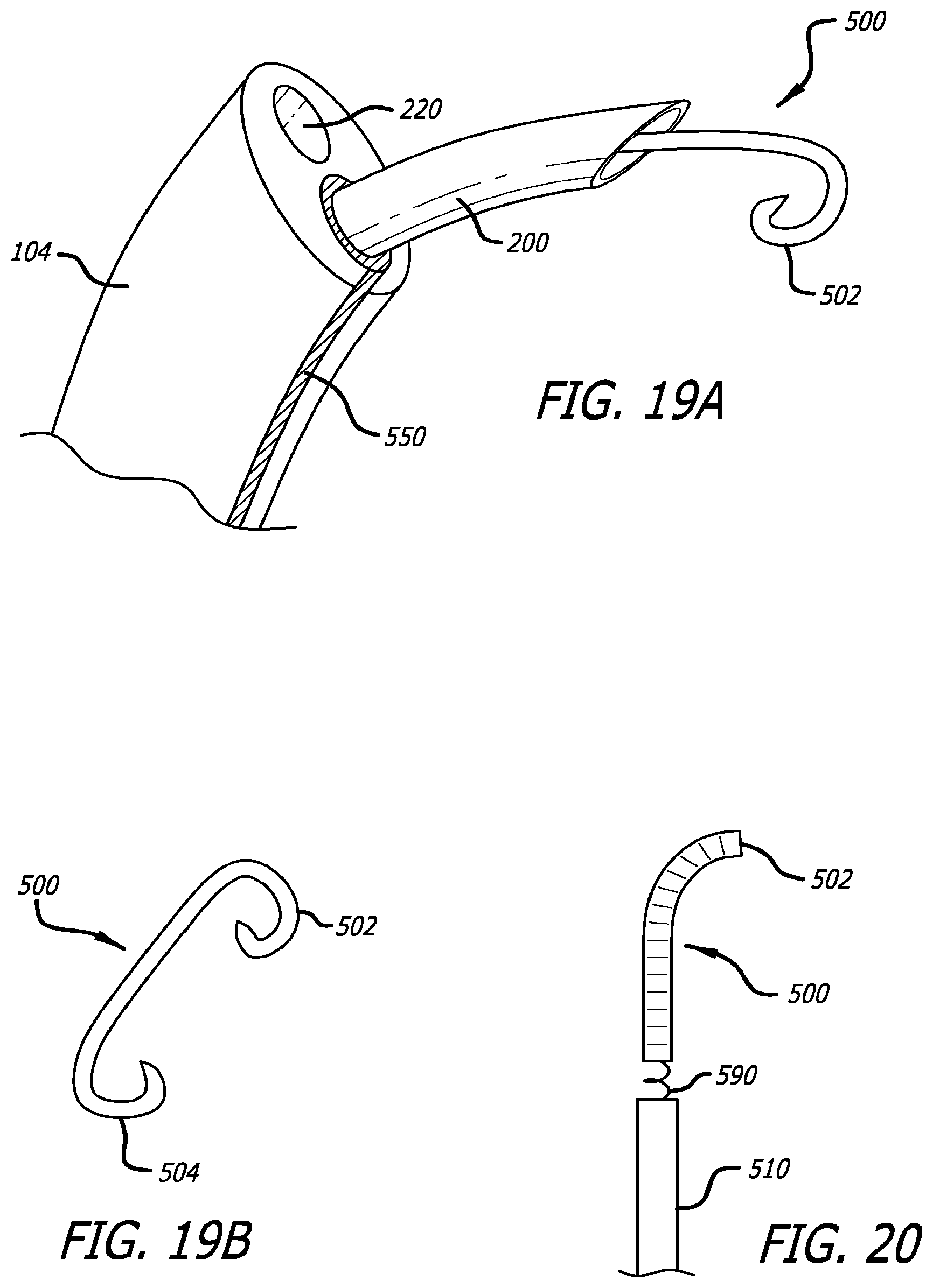 Patent US12376842 Figure 20 – Flexible system for delivering an anchor