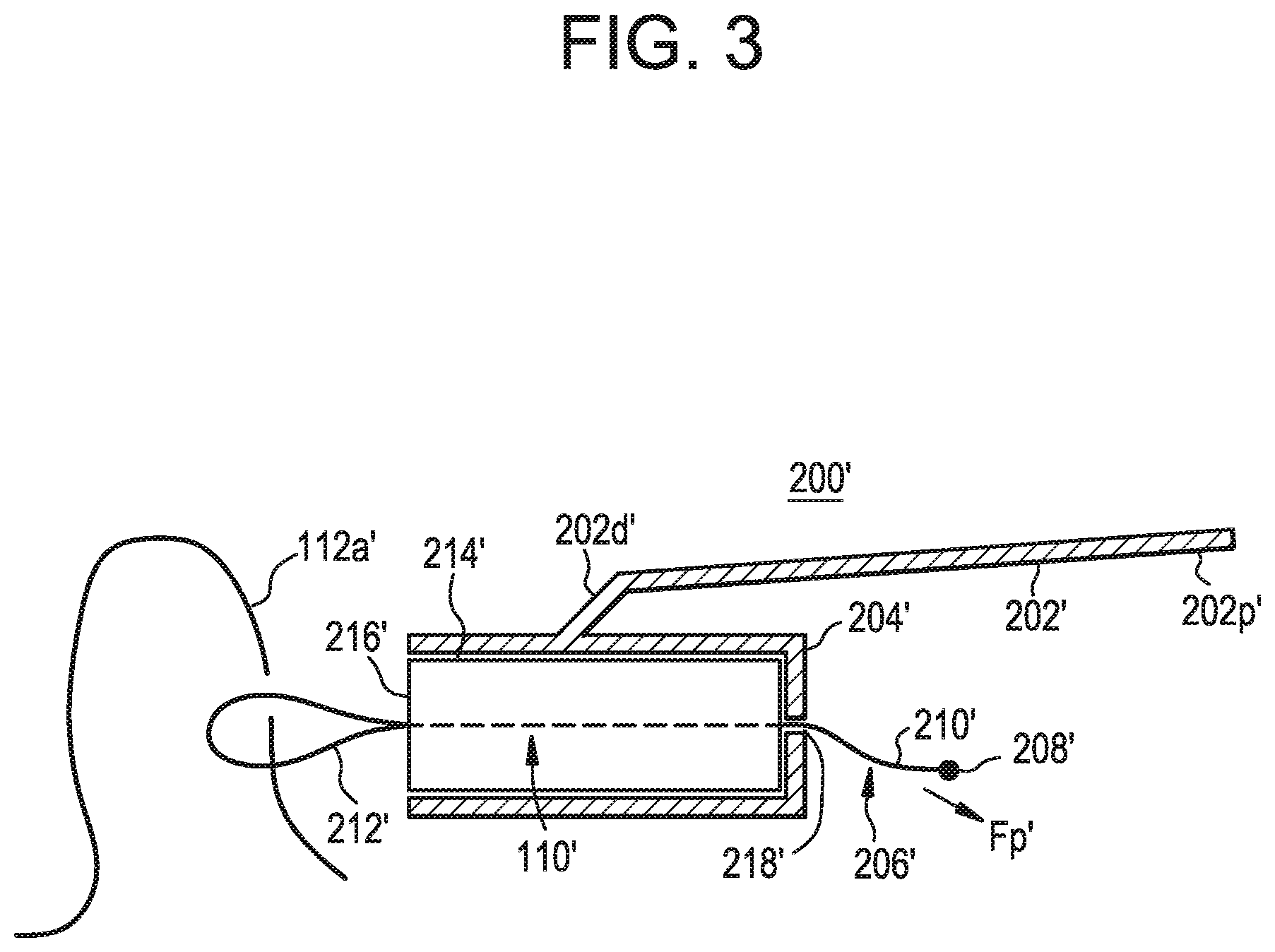 Patent US12376843 Figure 6 – Tissue augmentation tacks for use with soft tissue fixation repair systems and methods