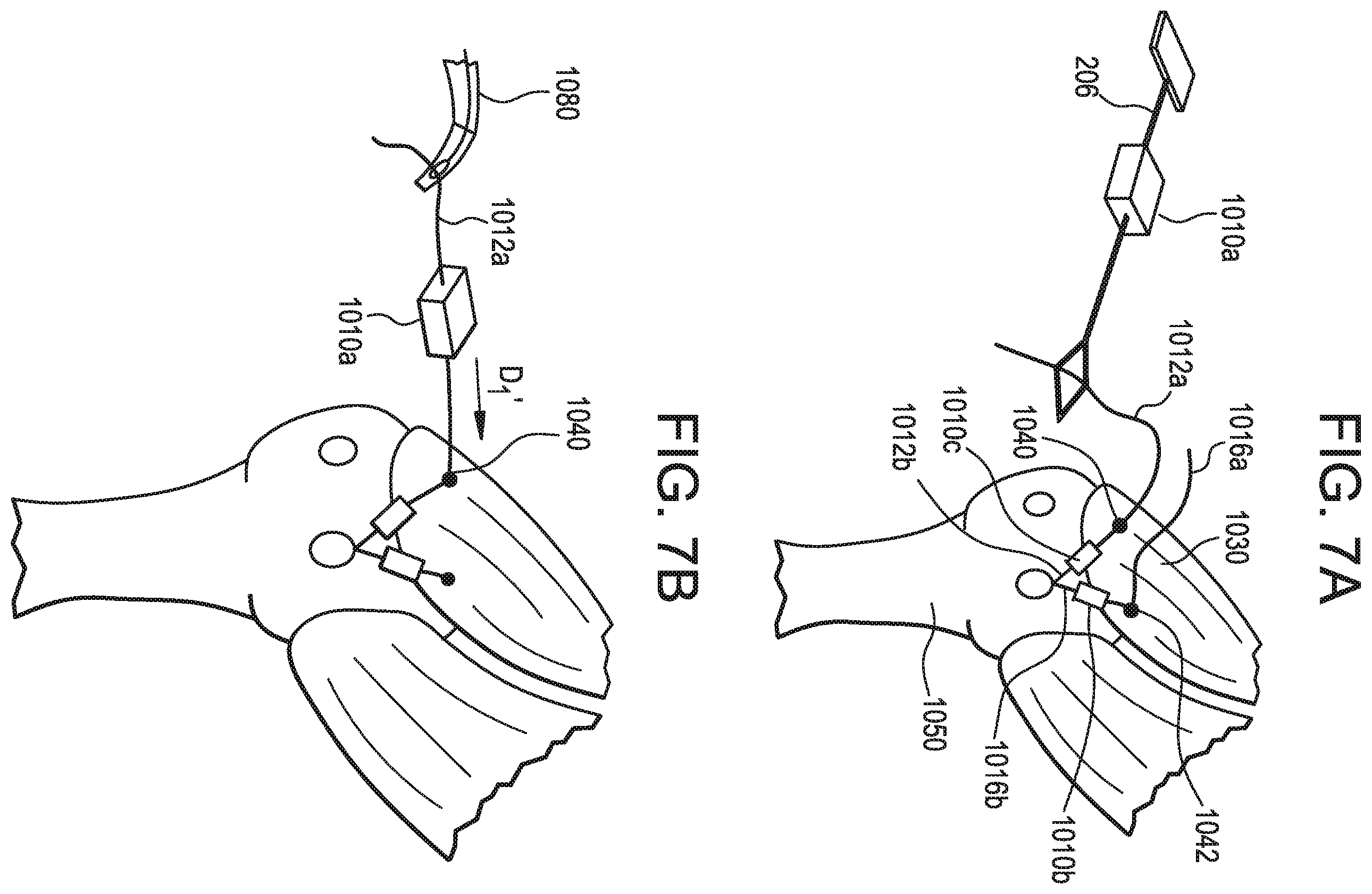 Patent US12376843 Figure 10 – Tissue augmentation tacks for use with soft tissue fixation repair systems and methods