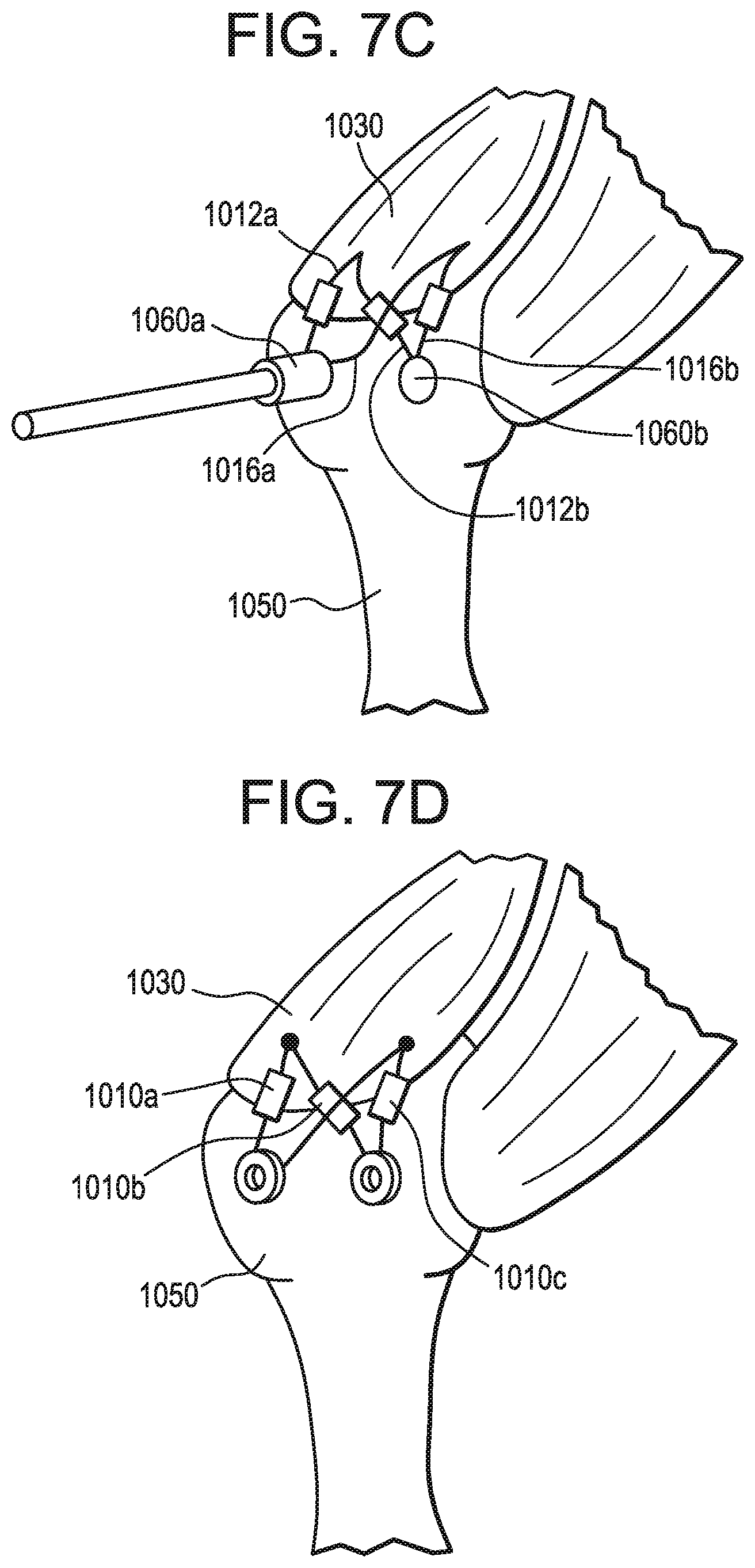 Patent US12376843 Figure 11 – Tissue augmentation tacks for use with soft tissue fixation repair systems and methods