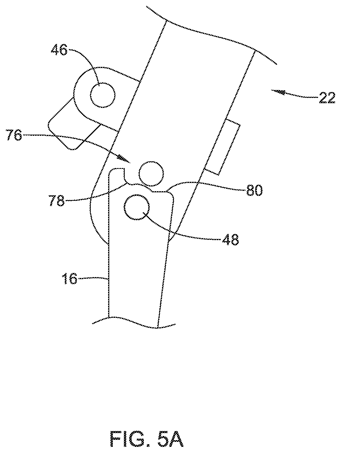 Patent US12376844 Figure 5 – Suture based closure device