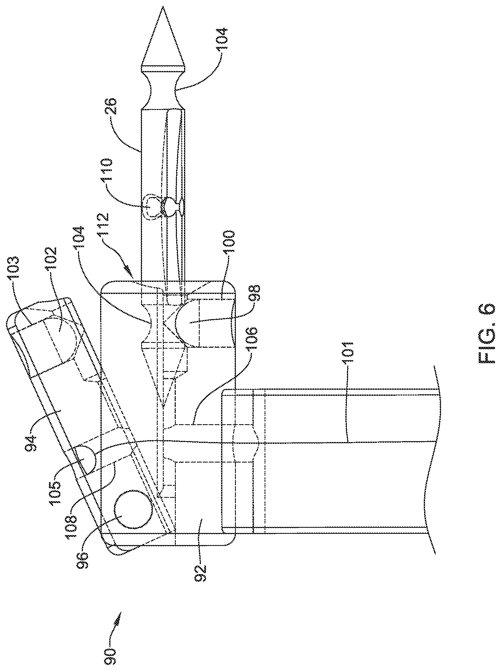 Patent US12376844 Figure 7 – Suture based closure device