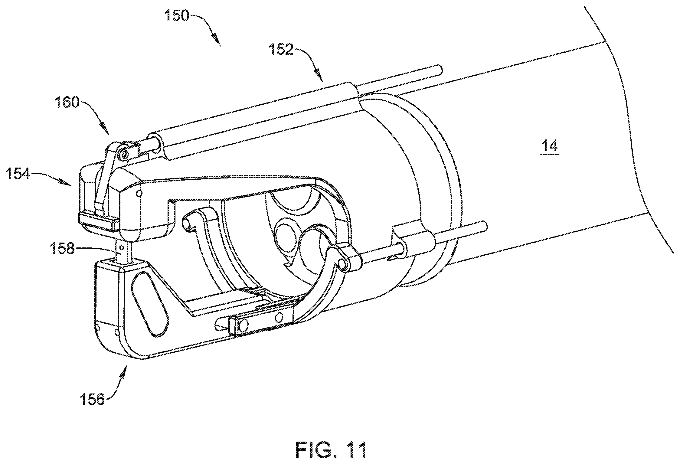 Patent US12376844 Figure 15 – Suture based closure device