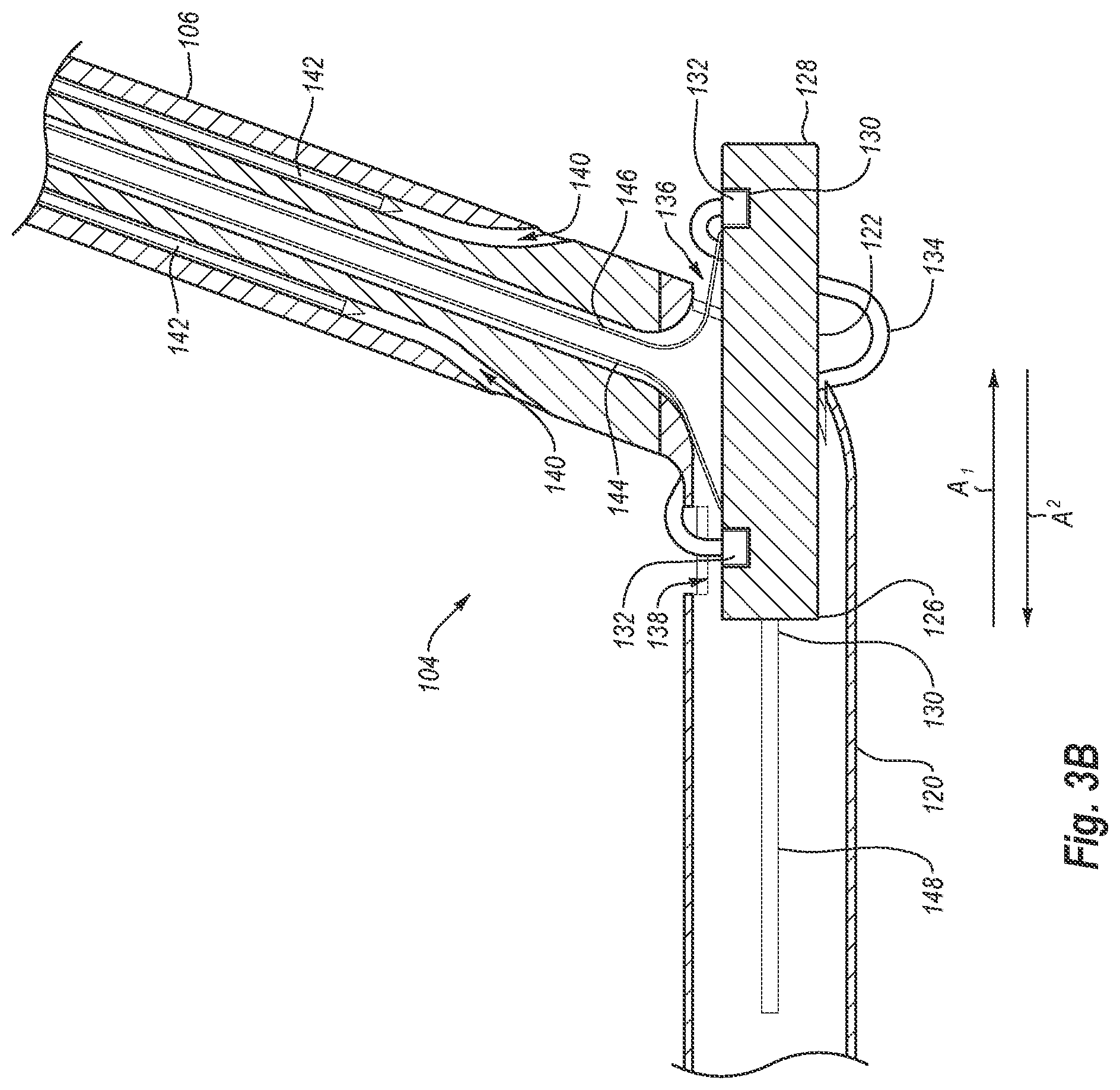Patent US12376845 Figure 4 – Systems, methods, and devices for closing holes in body lumens