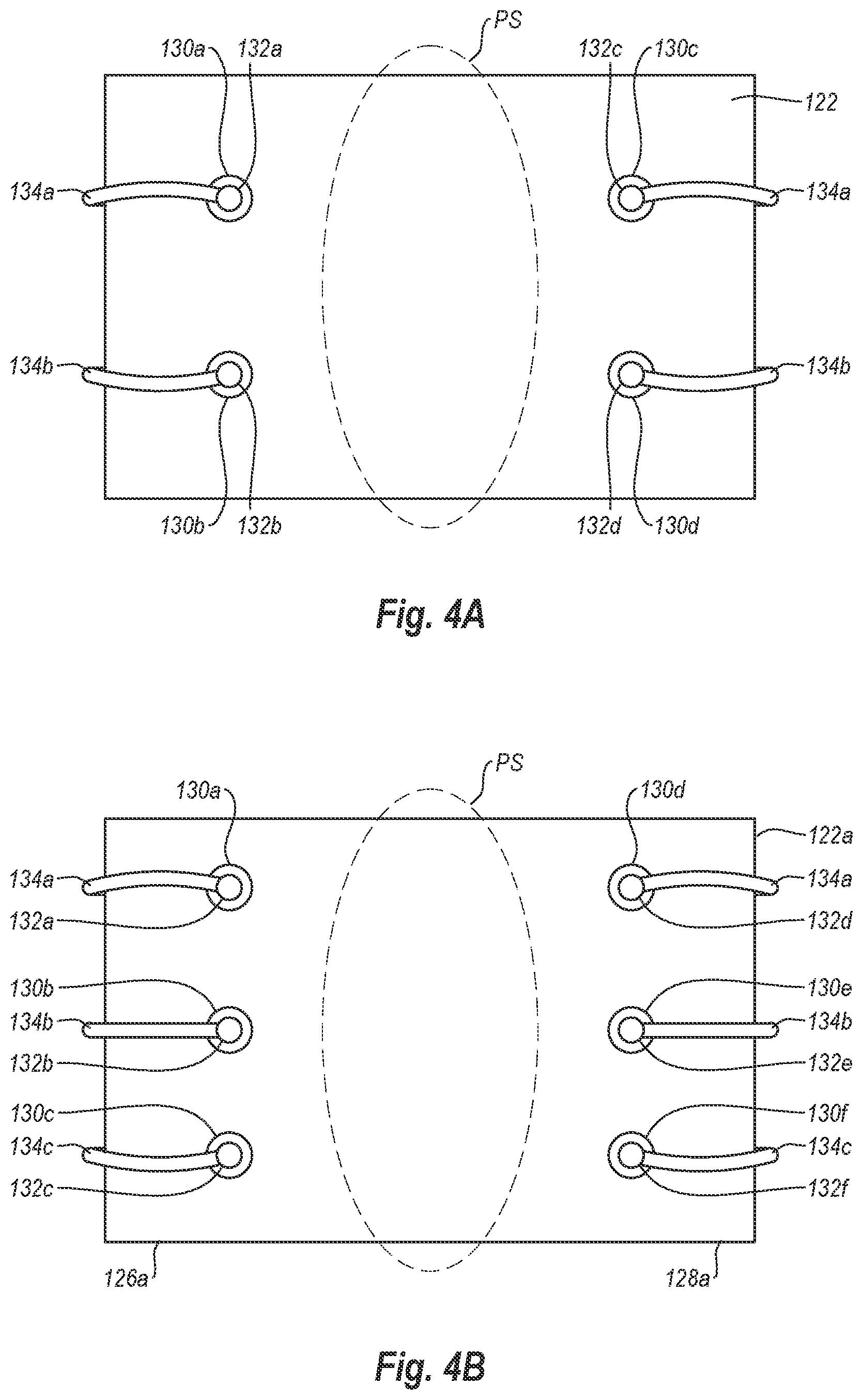 Patent US12376845 Figure 5 – Systems, methods, and devices for closing holes in body lumens